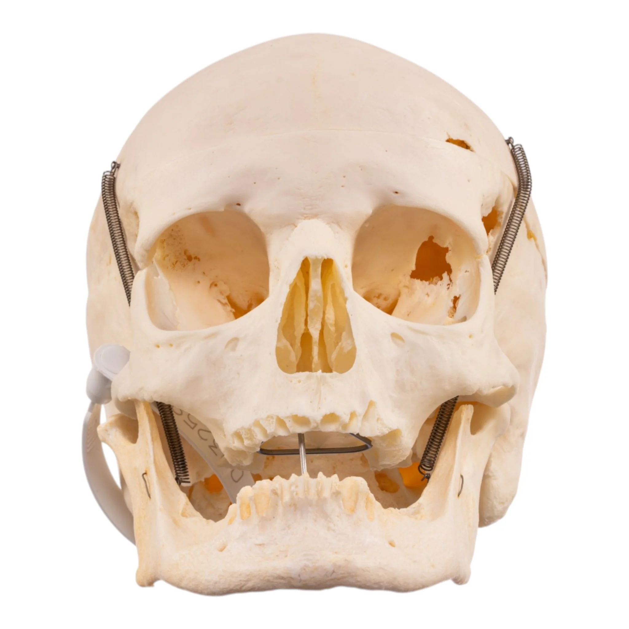 Real Human Skull - Image 3
