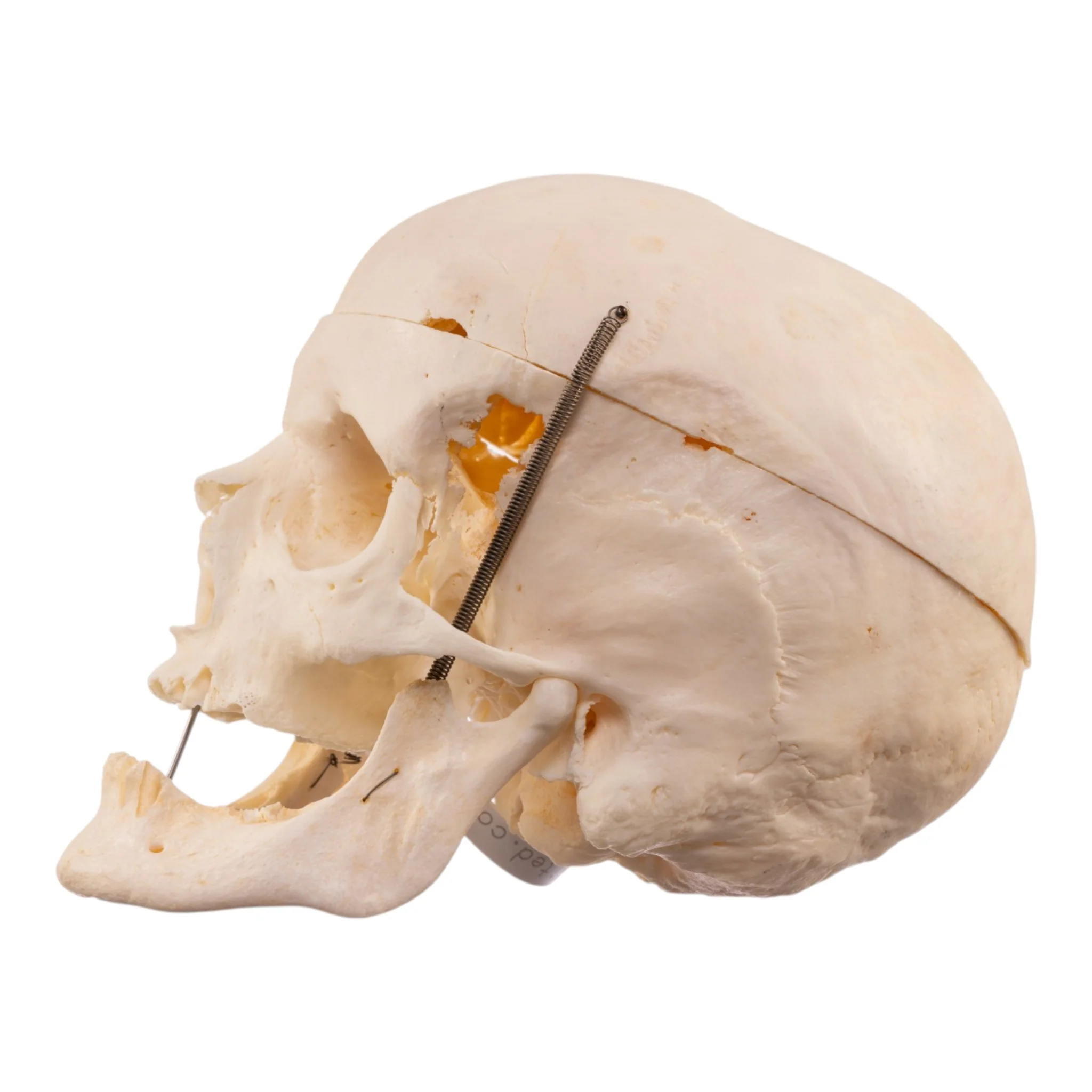 Real Human Skull - Image 4