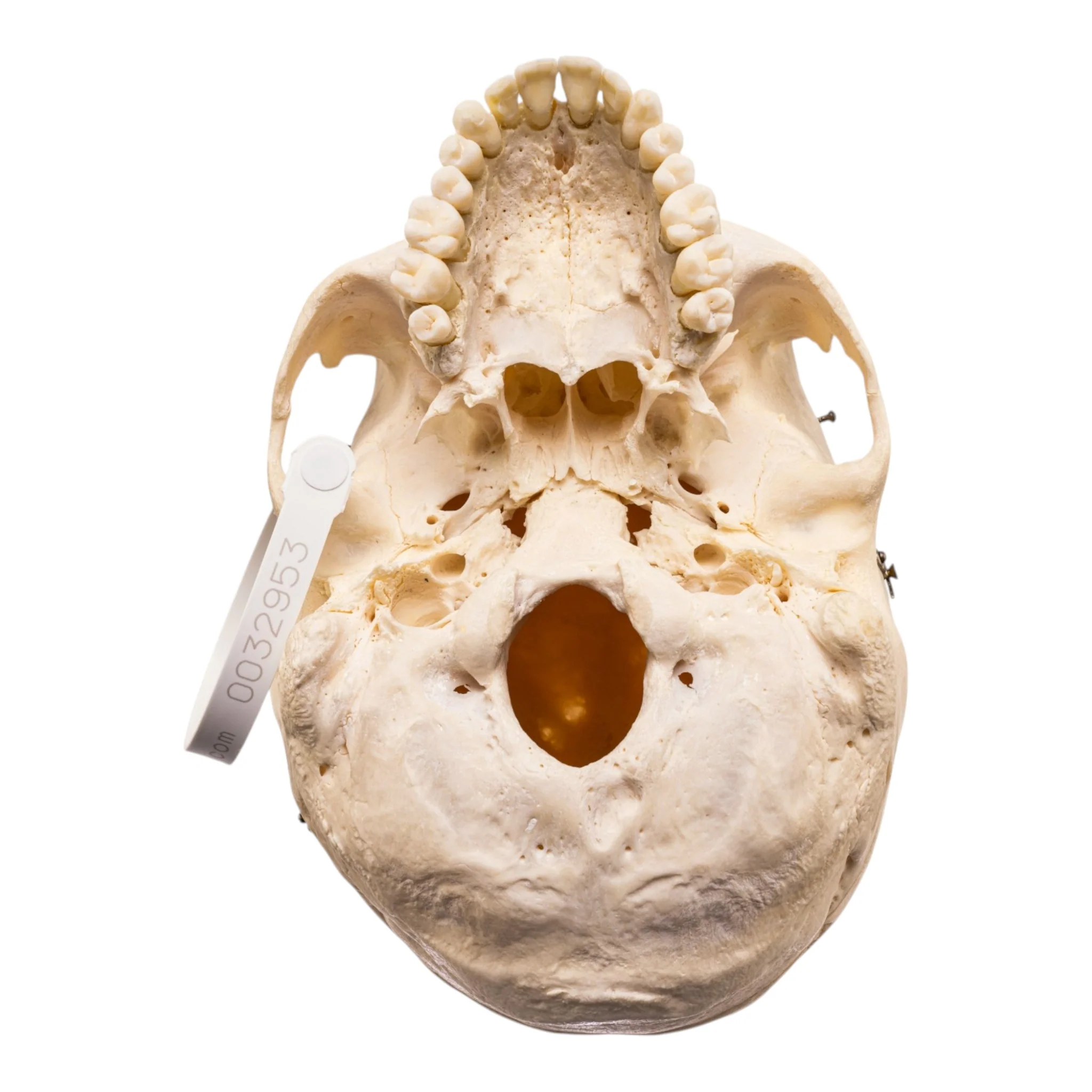 Real Human Skull - Image 6