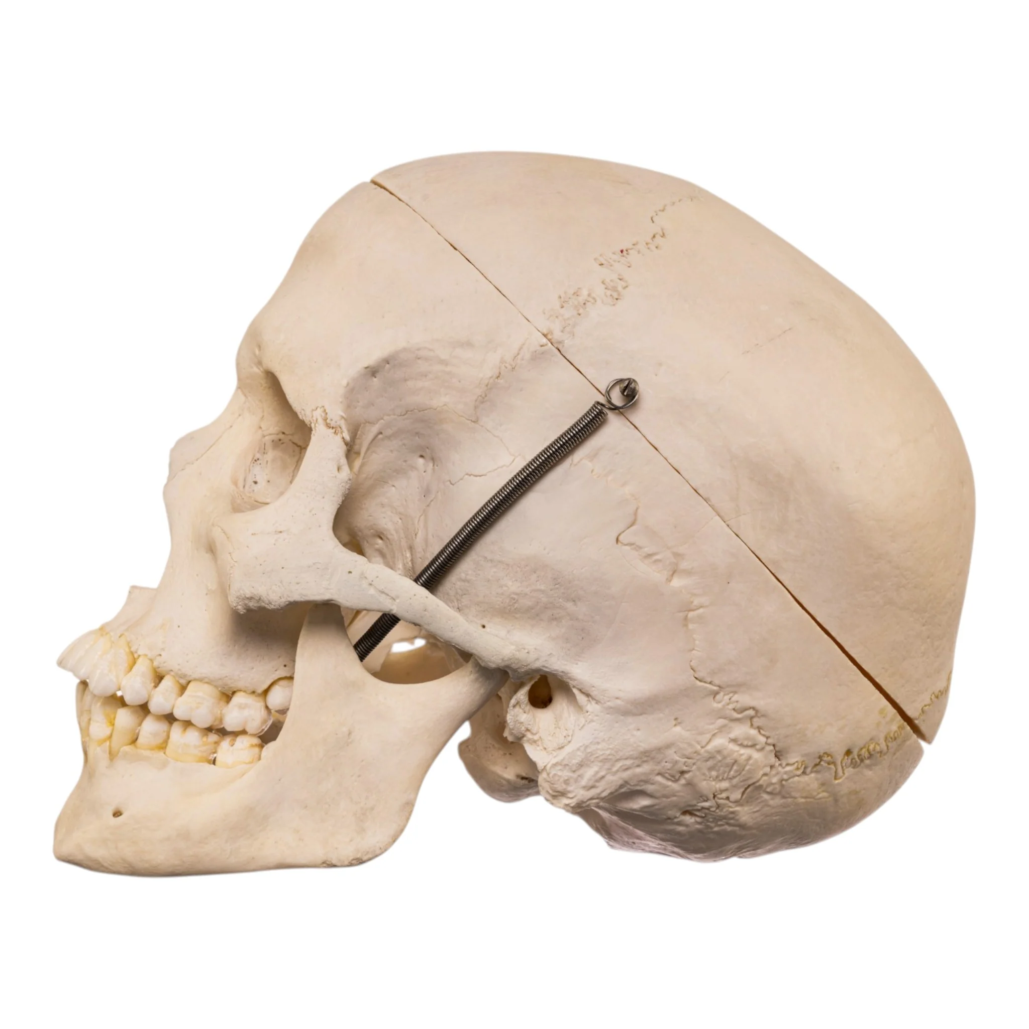 Real Human Skull - Image 4