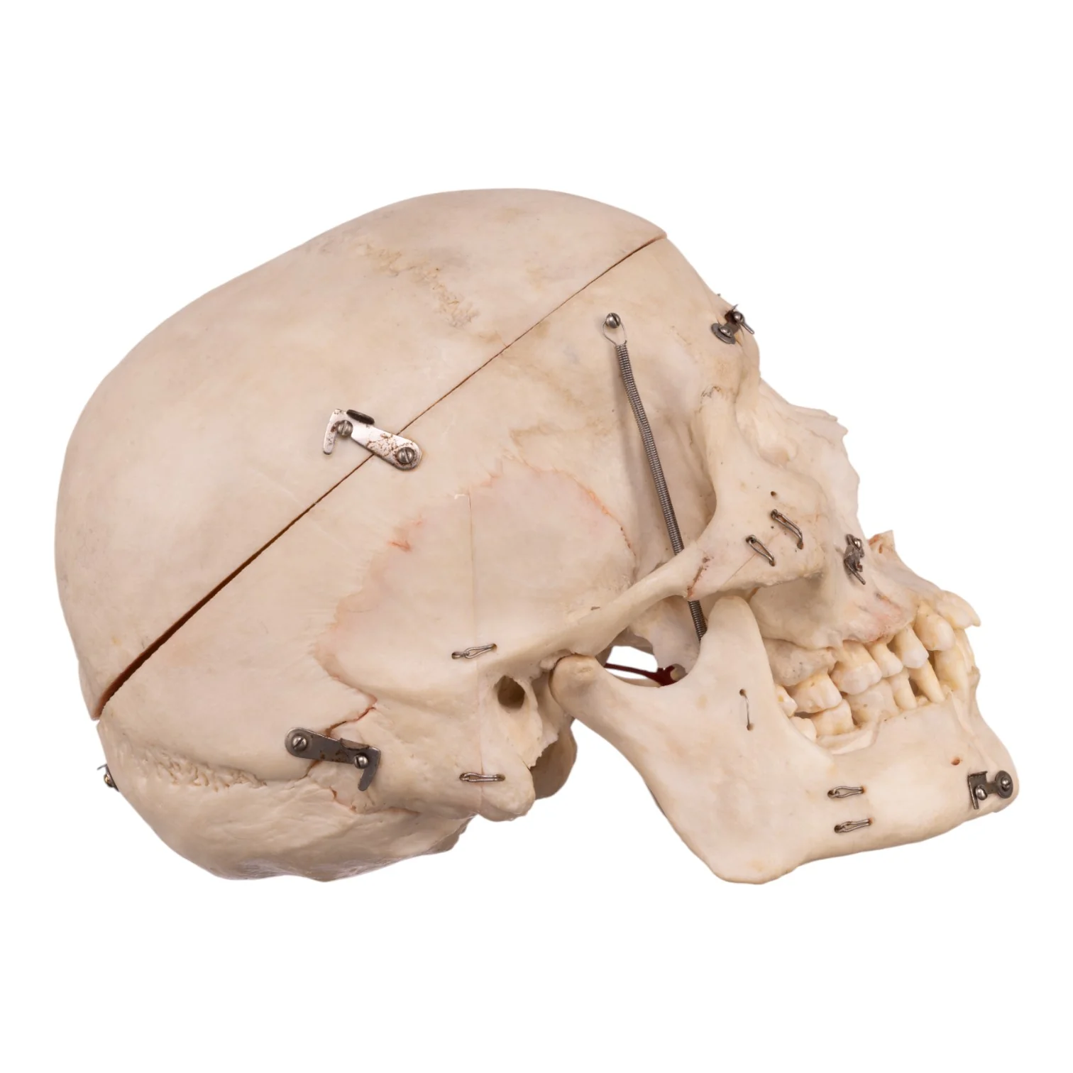 Real Human Dissected Skull with Carrying Case - Image 3