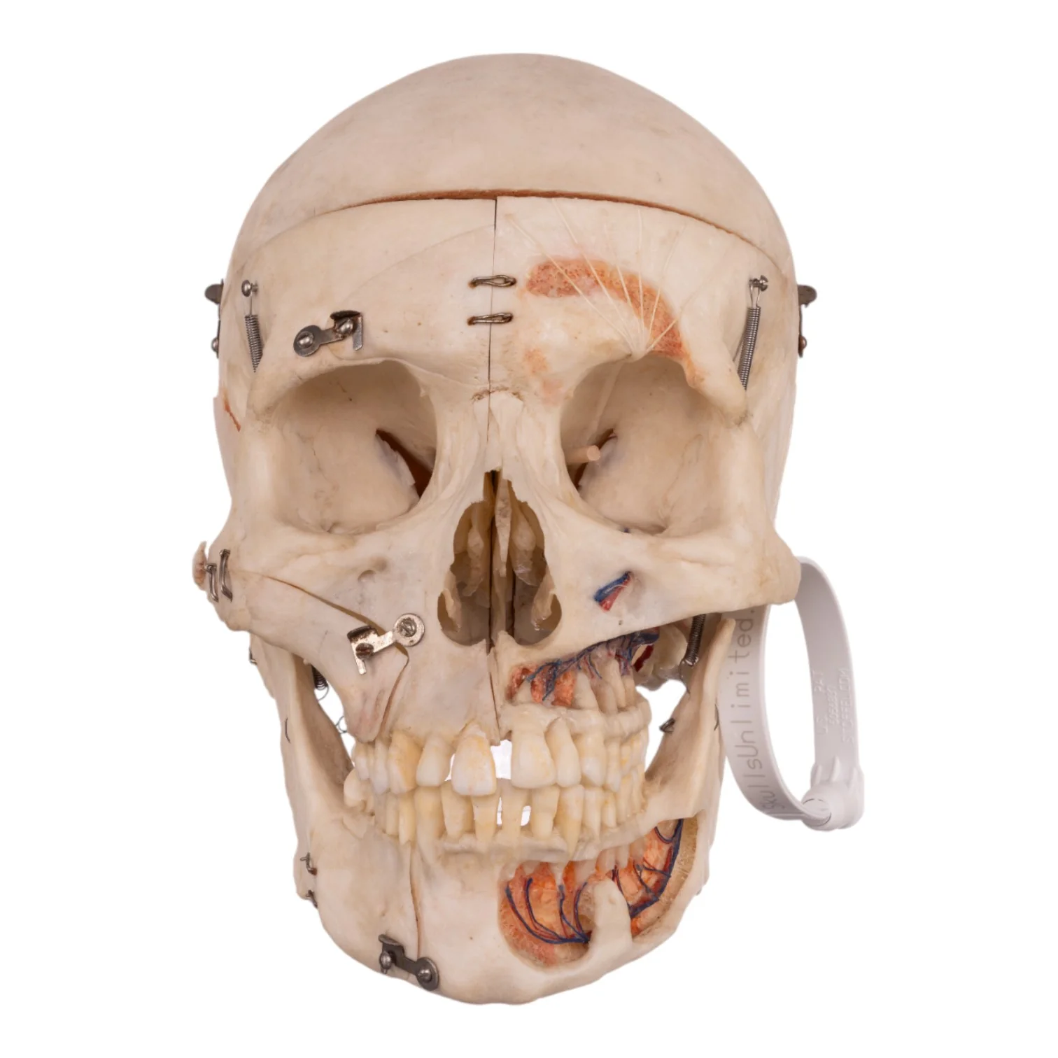 Real Human Dissected Skull with Carrying Case - Image 4