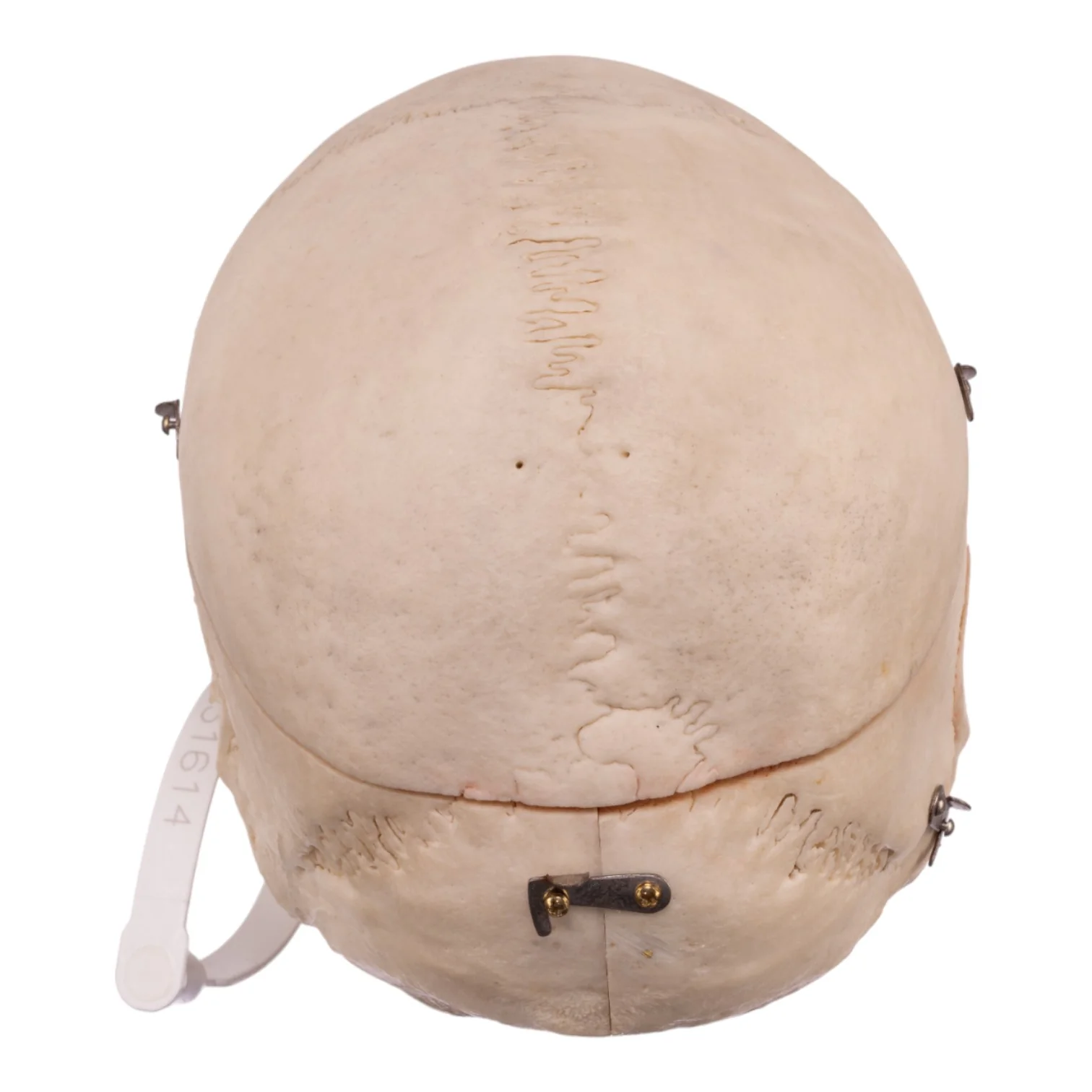 Real Human Dissected Skull with Carrying Case - Image 6