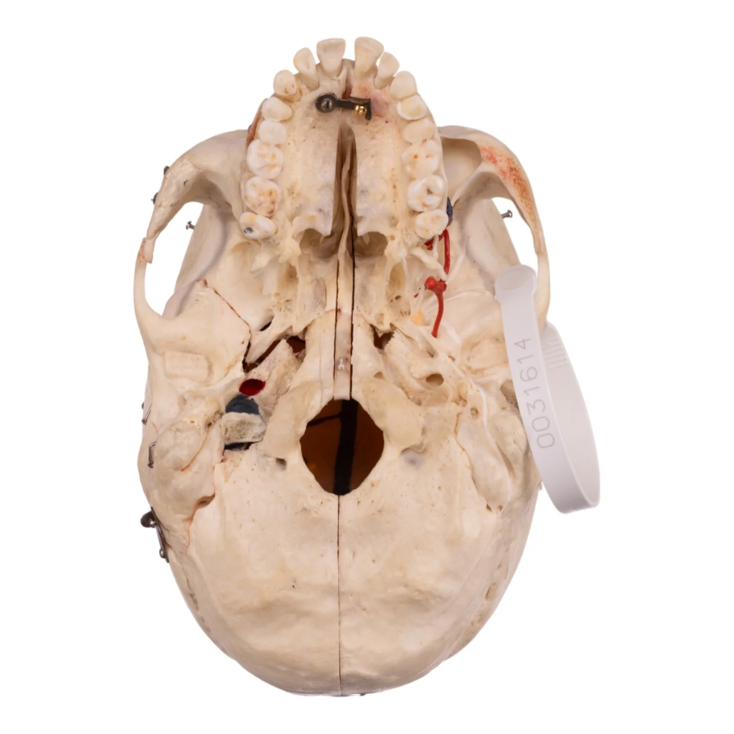 Real Human Dissected Skull with Carrying Case - Image 7