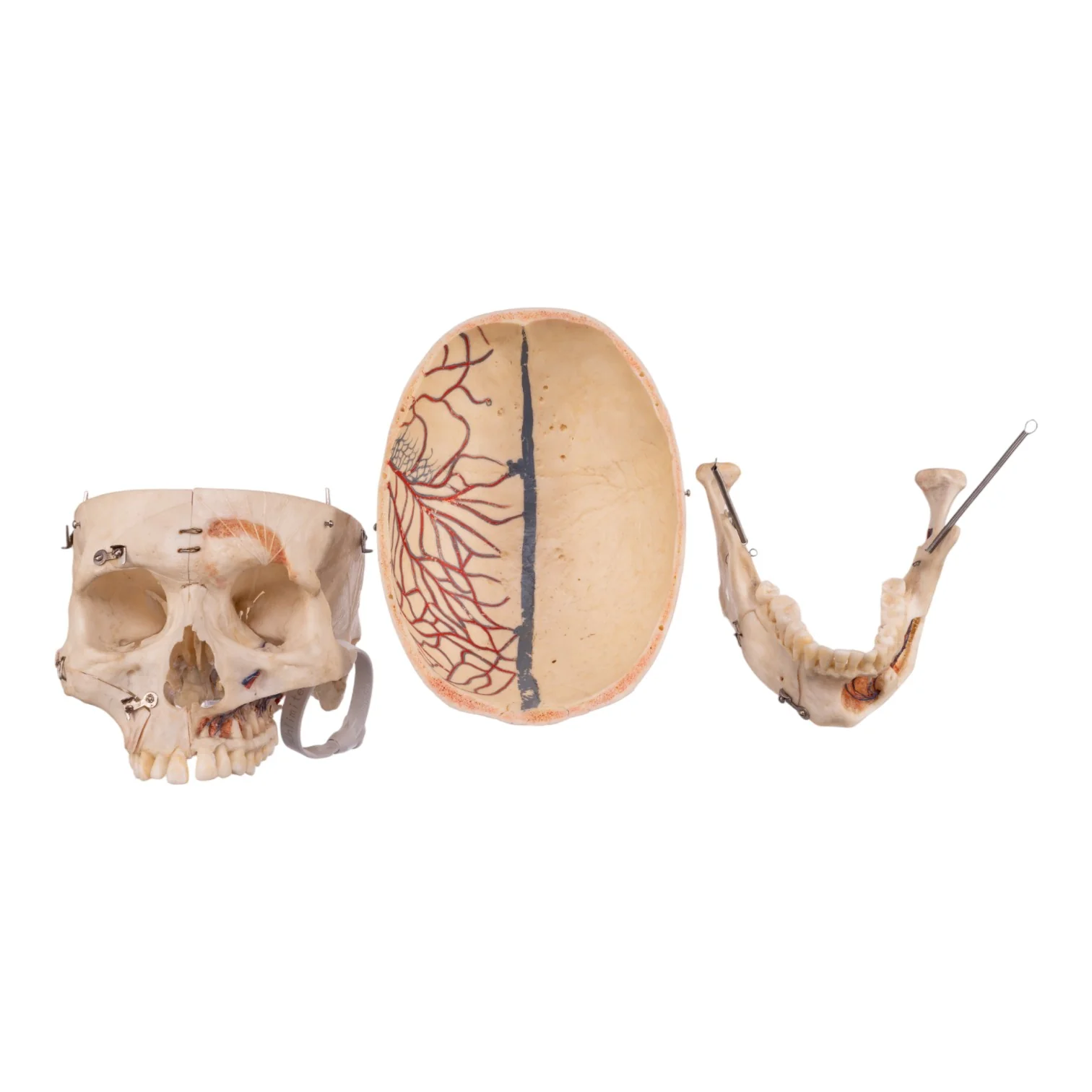 Real Human Dissected Skull with Carrying Case - Image 8