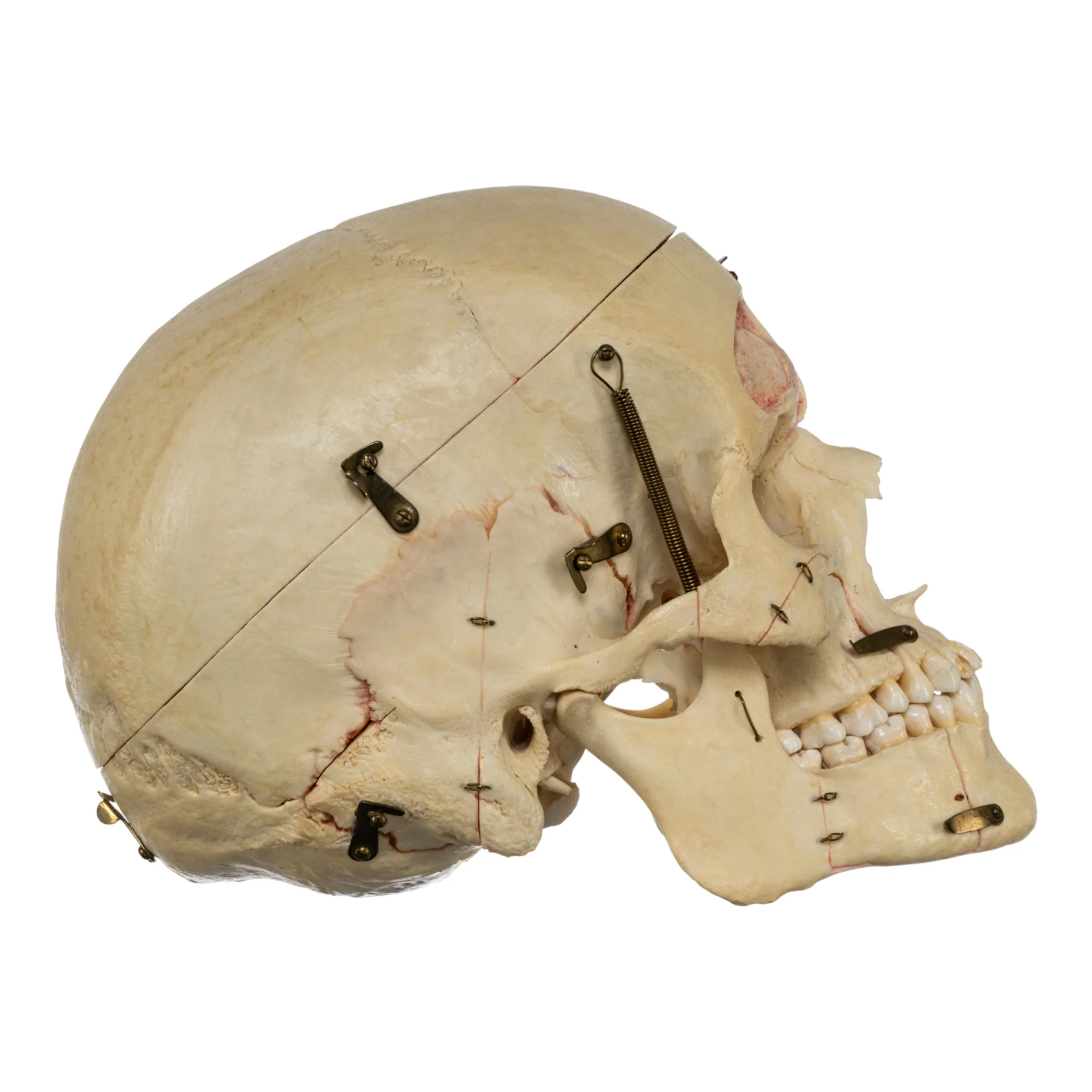 Real Human Dissected Skull in Carrying Case - Image 3