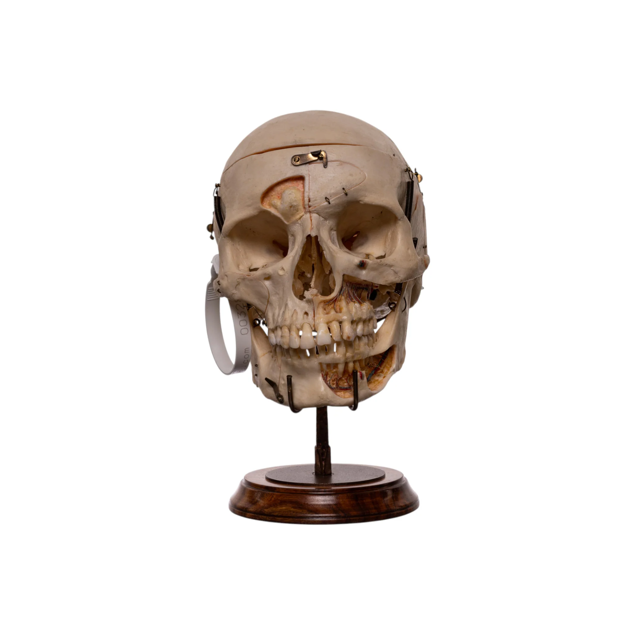 Real Human Skull - Dissected - With Stand