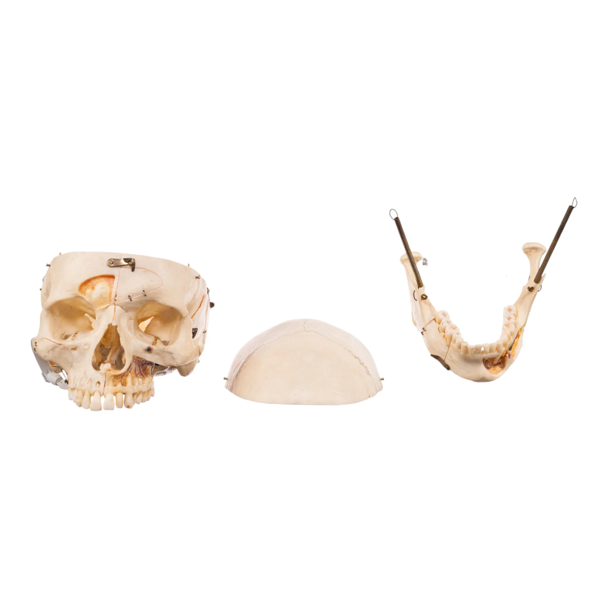 Real Human Skull - Dissected - With Stand - Image 10