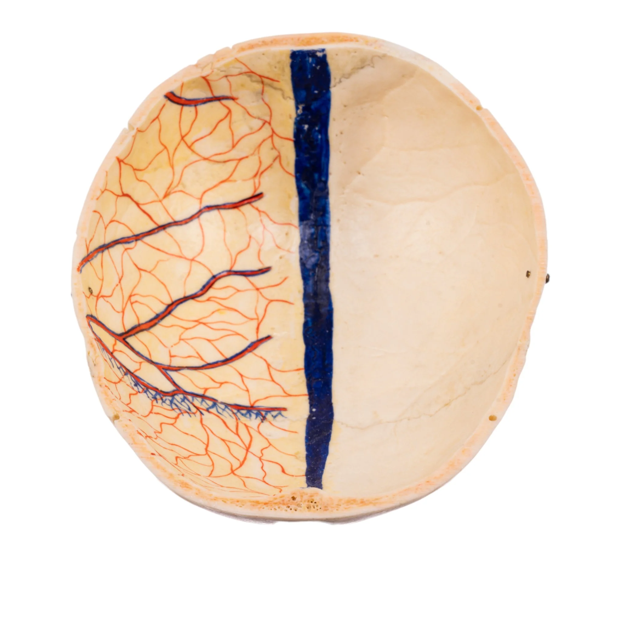 Real Human Skull - Dissected - With Stand - Image 8