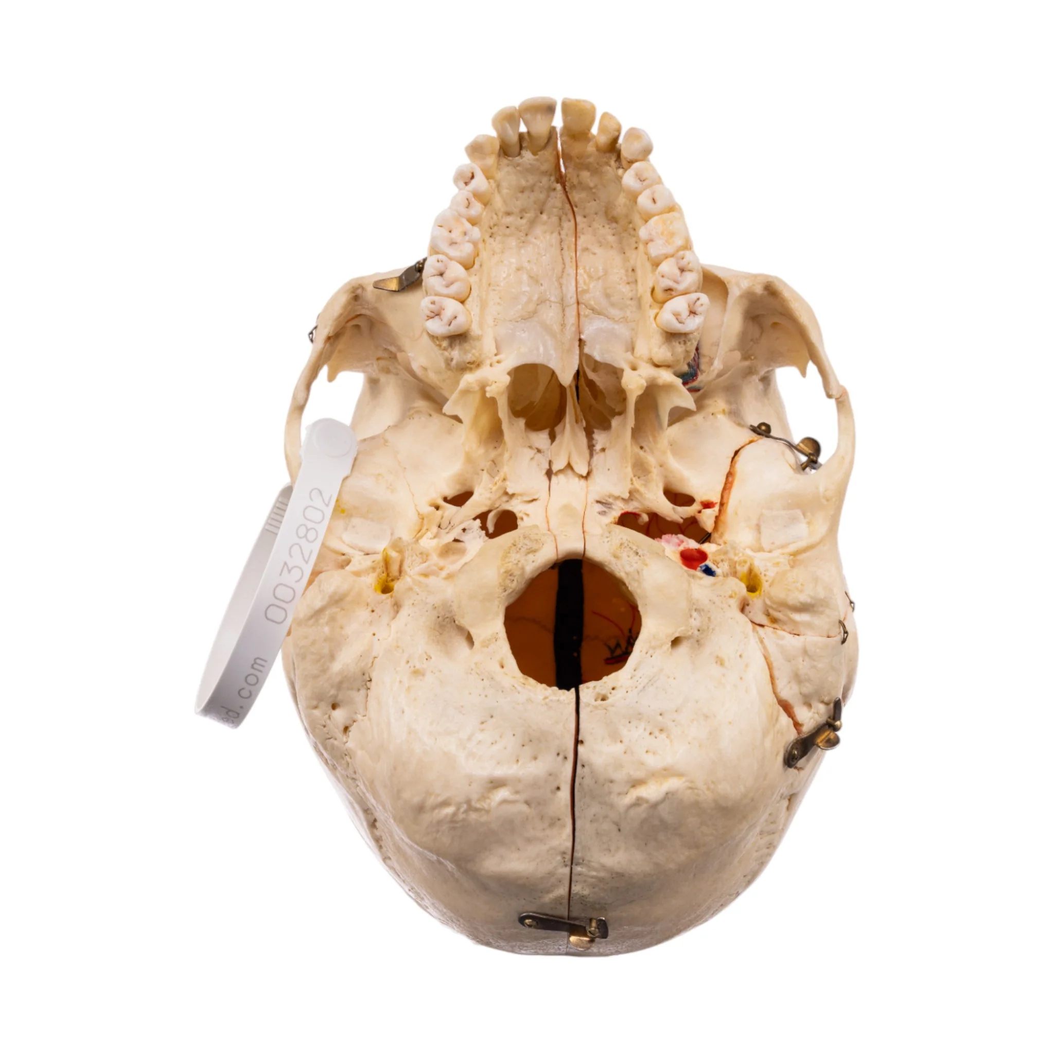 Real Human Skull - Dissected - With Stand - Image 9