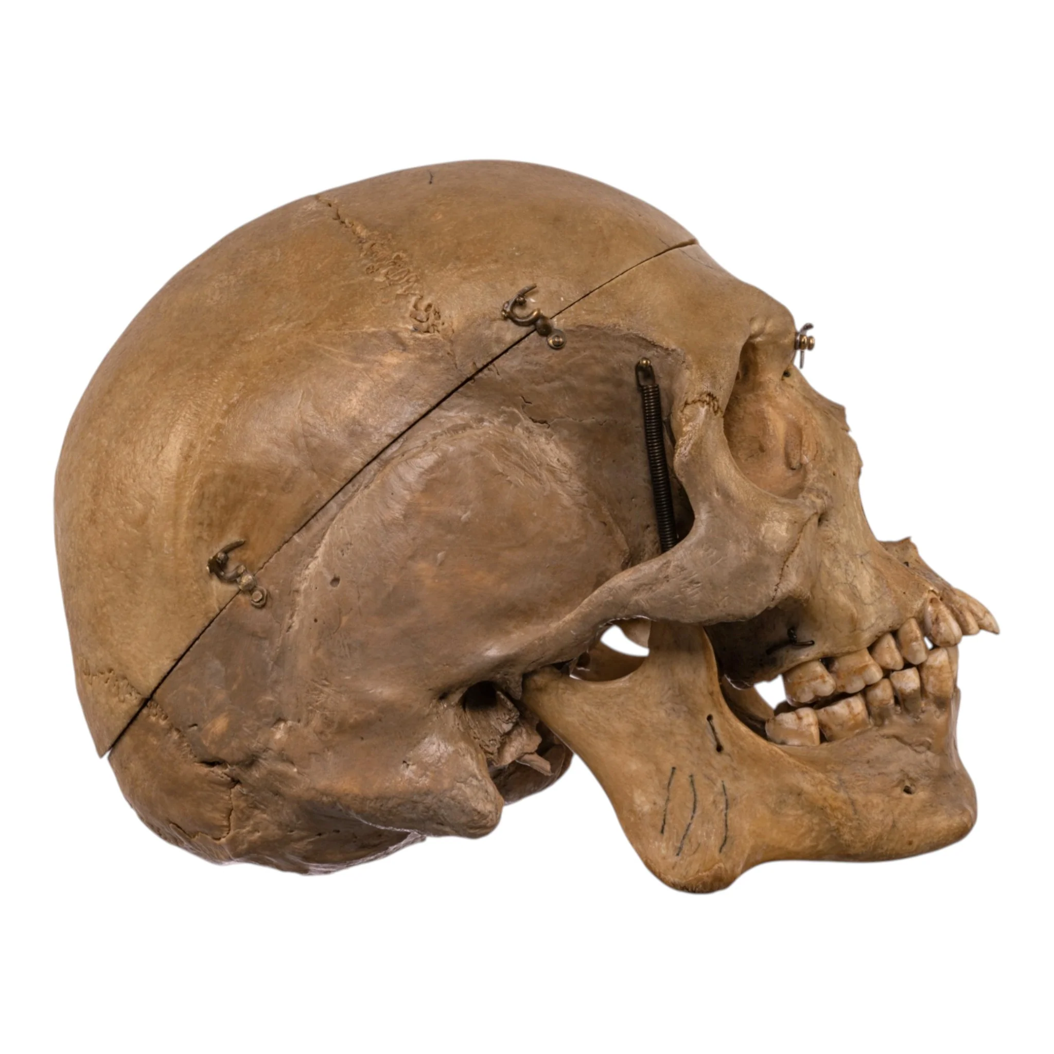Real Human Skull - Dissected - Image 2