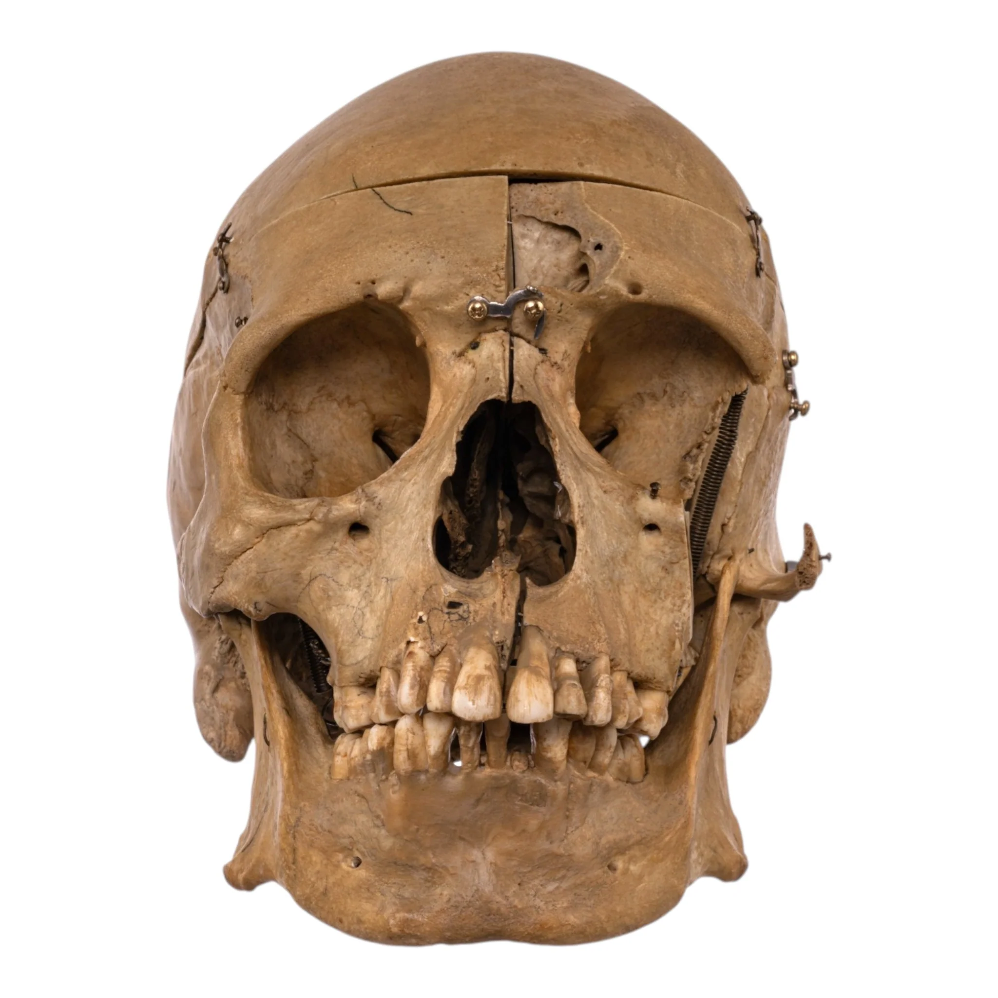 Real Human Skull - Dissected - Image 3
