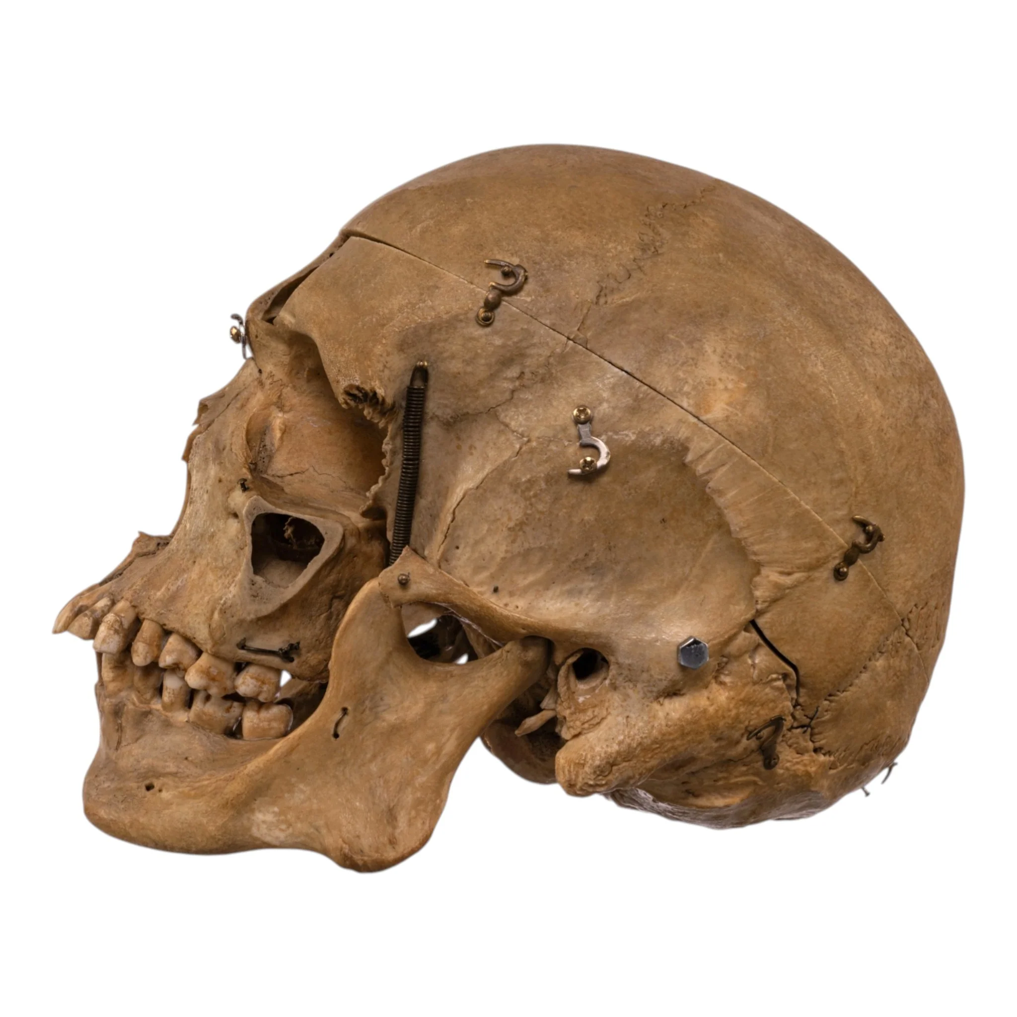 Real Human Skull - Dissected - Image 4