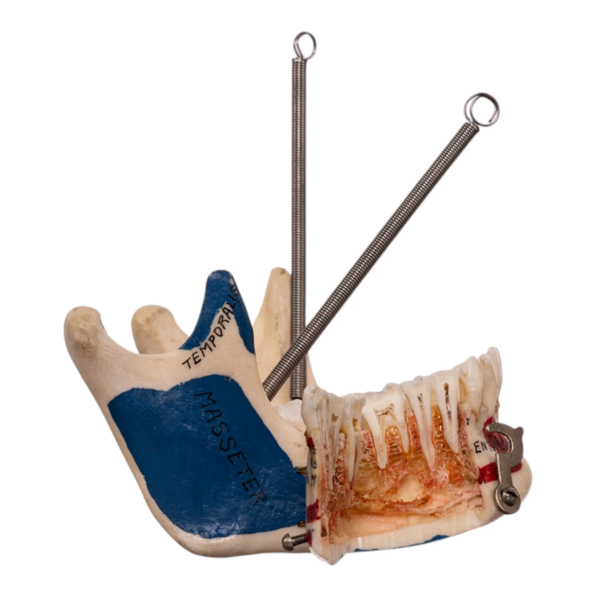 Real Human Dissected Skull in Carrying Case - Image 11
