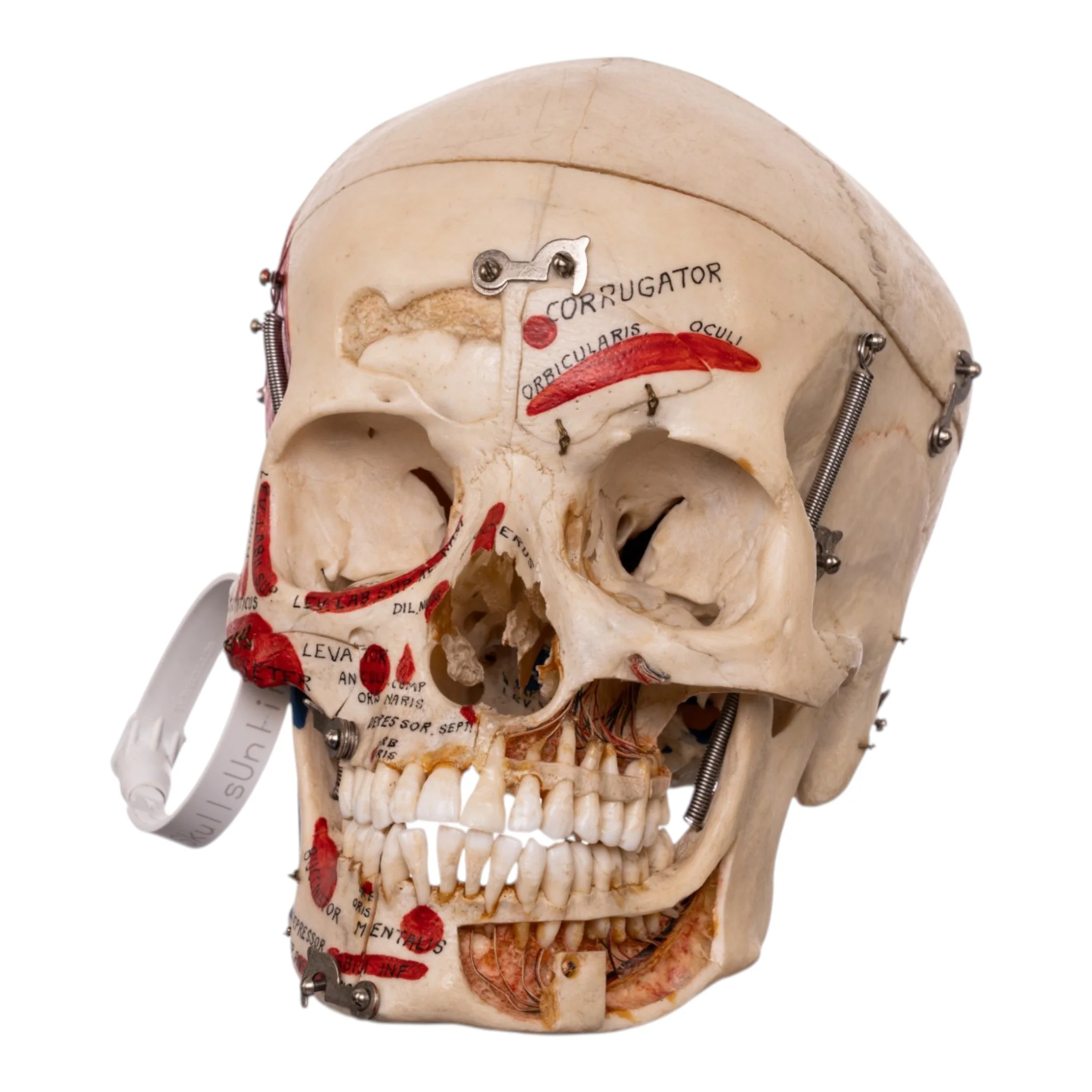 Real Human Dissected Skull in Carrying Case - Image 2