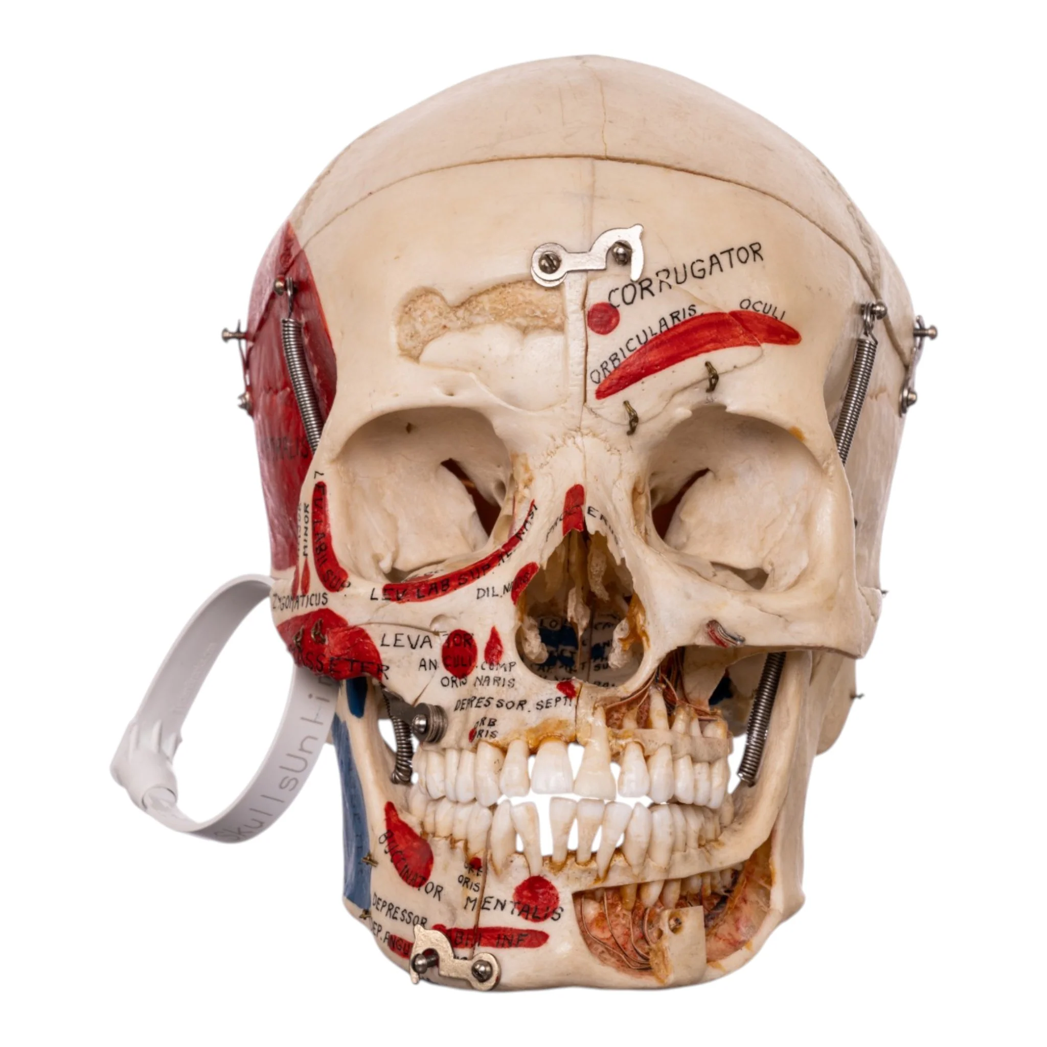Real Human Dissected Skull in Carrying Case - Image 4