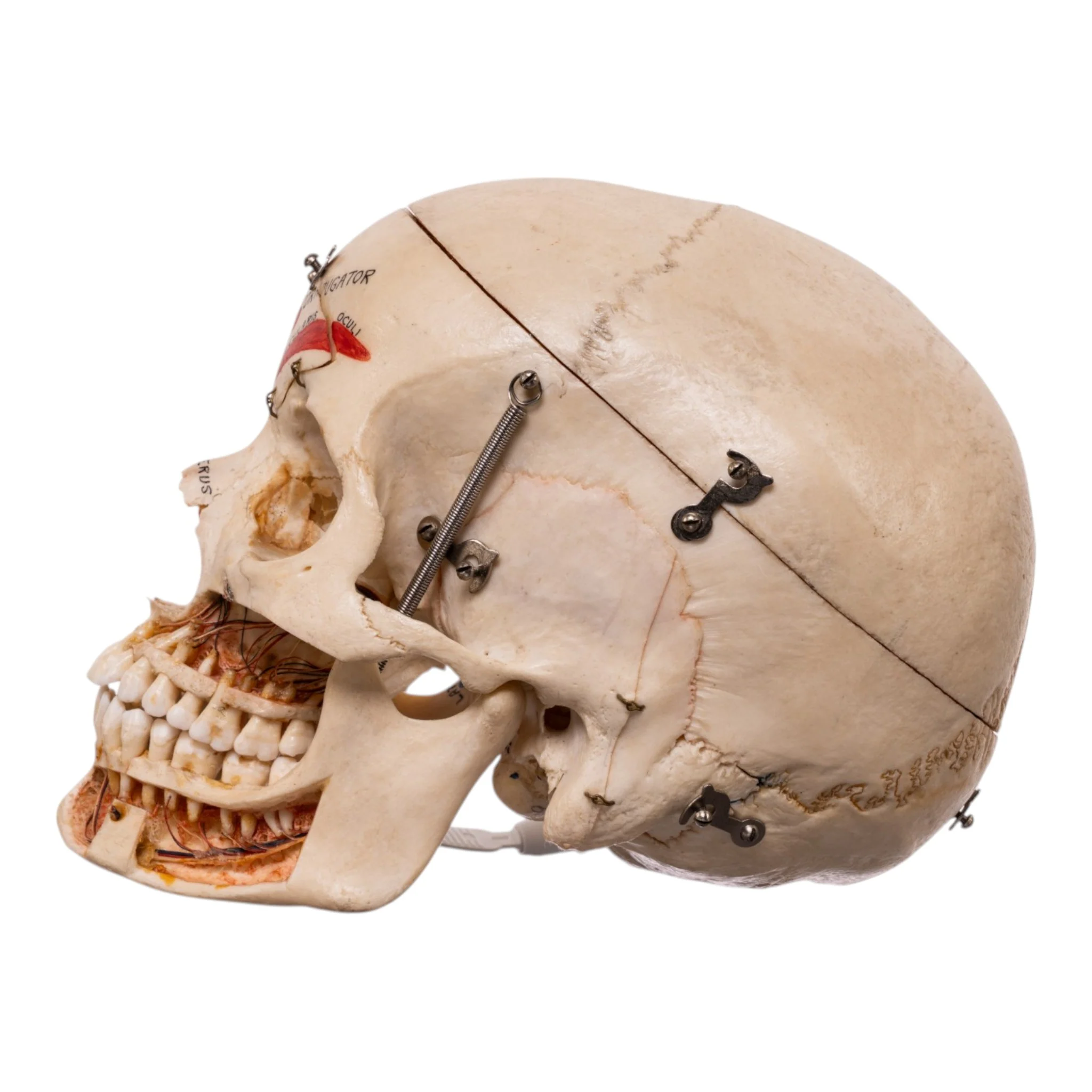 Real Human Dissected Skull in Carrying Case - Image 5