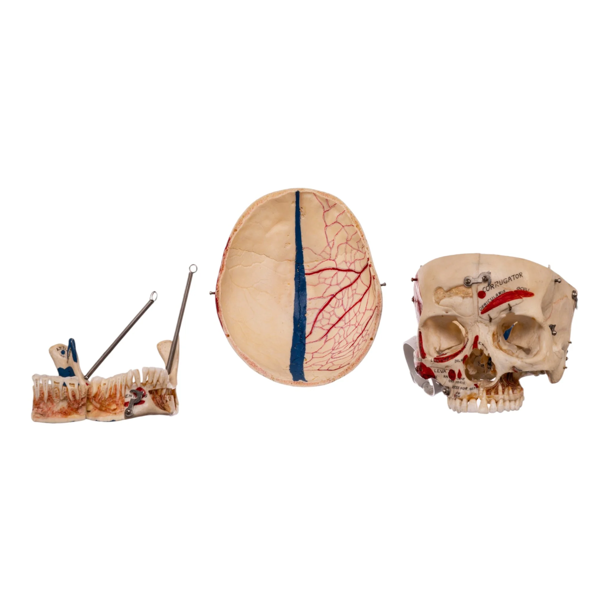 Real Human Dissected Skull in Carrying Case - Image 8
