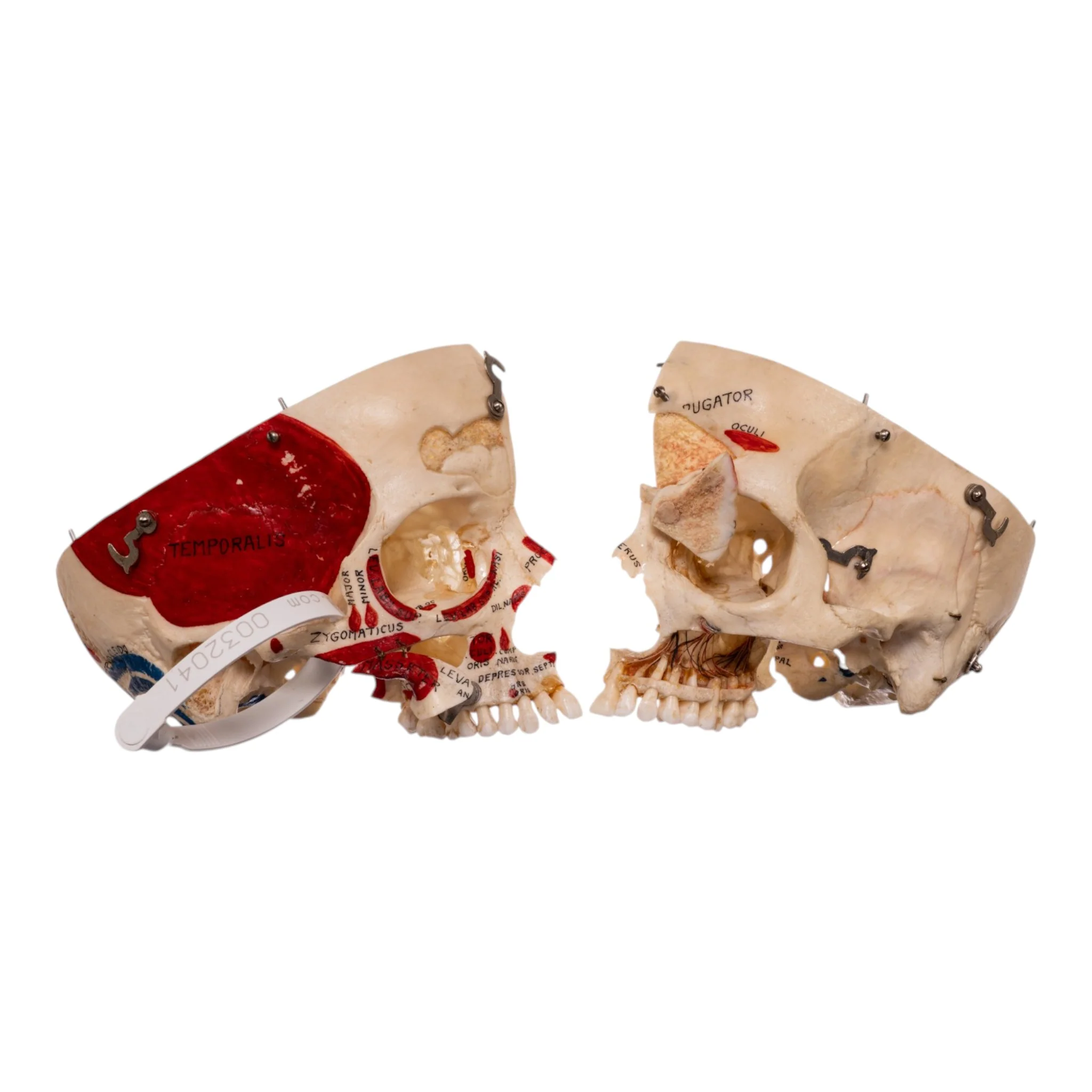 Real Human Dissected Skull in Carrying Case - Image 9