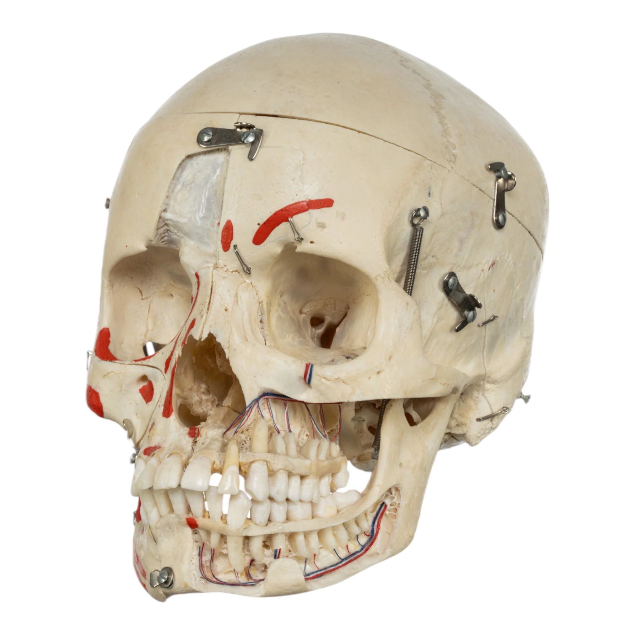 Real Human Skull - Dissected