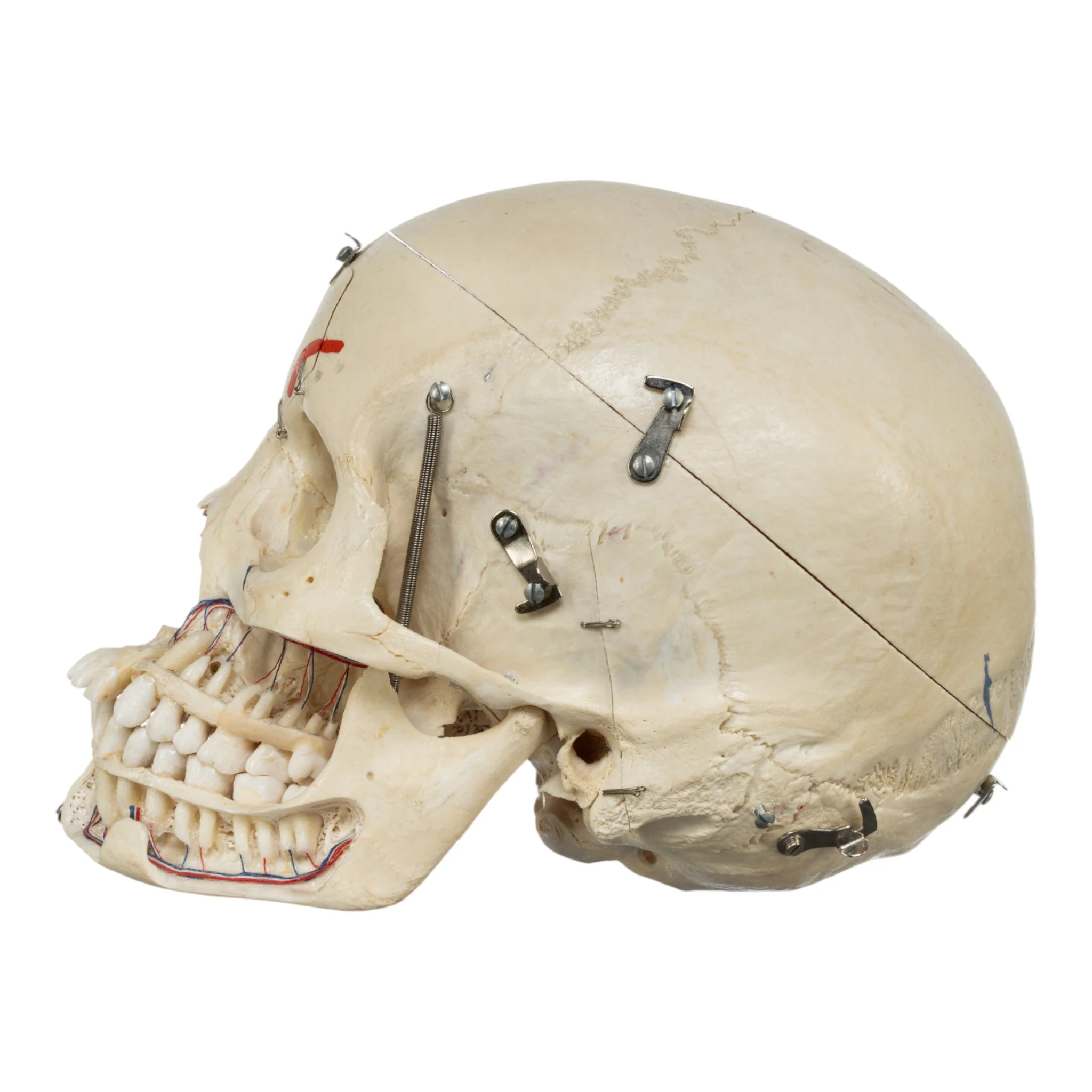 Real Human Skull - Dissected - Image 4