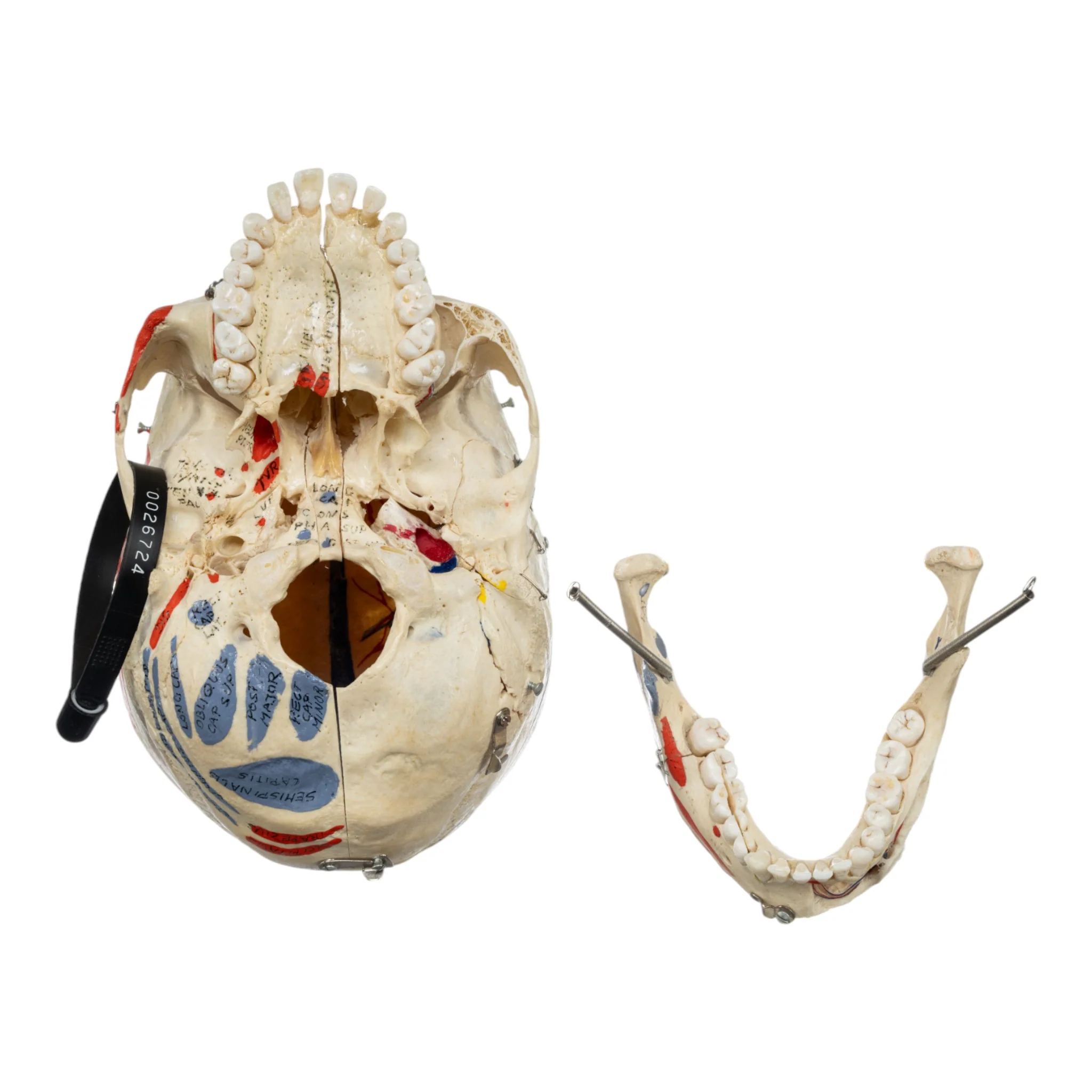 Real Human Skull - Dissected - Image 6