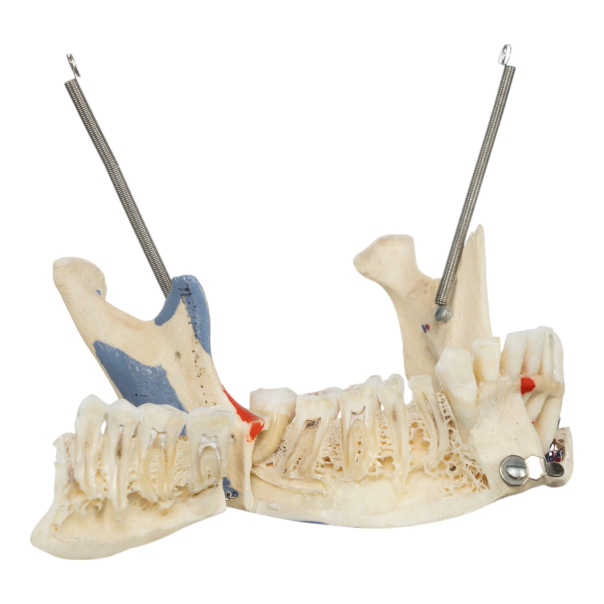 Real Human Skull - Dissected - Image 8