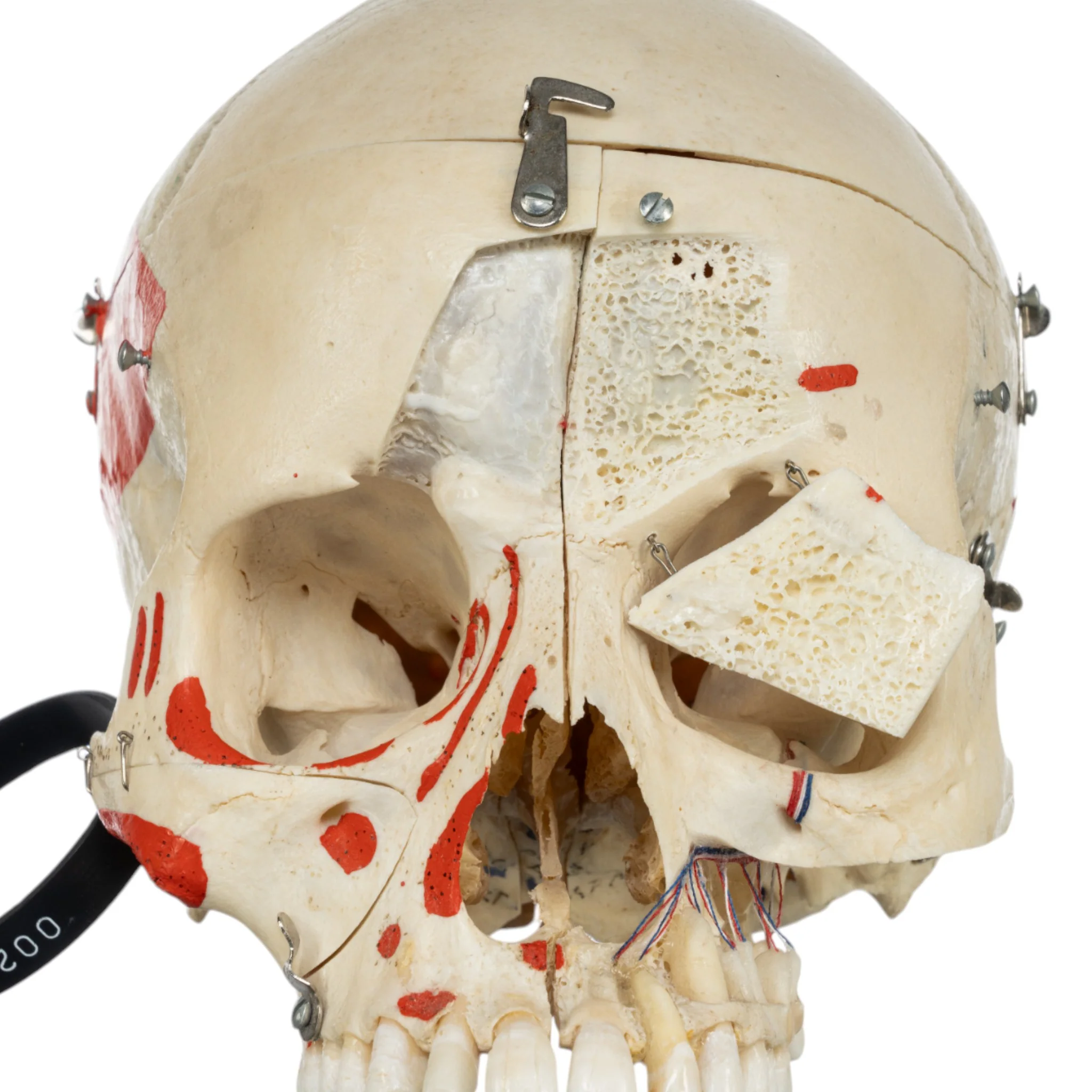 Real Human Skull - Dissected - Image 9