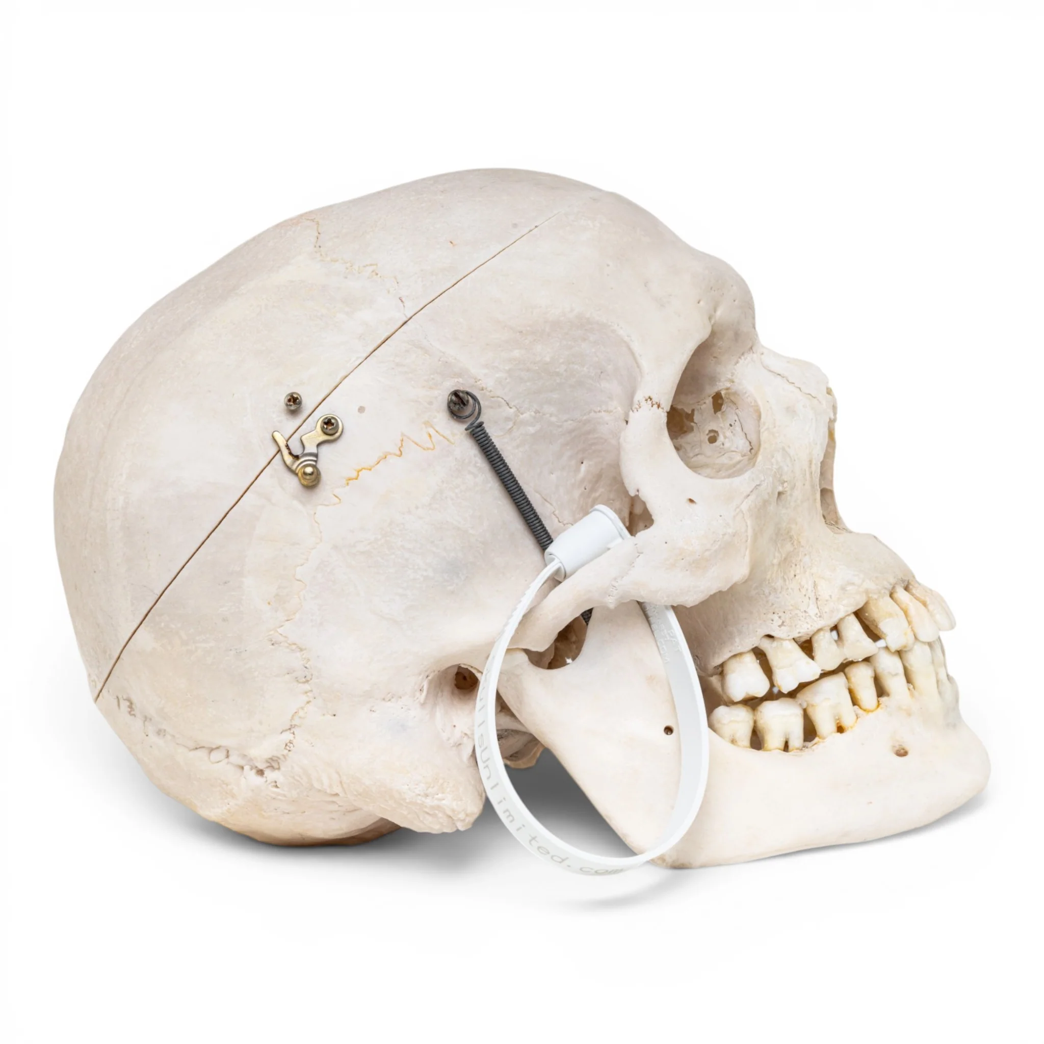 Real Human Skull - Image 2