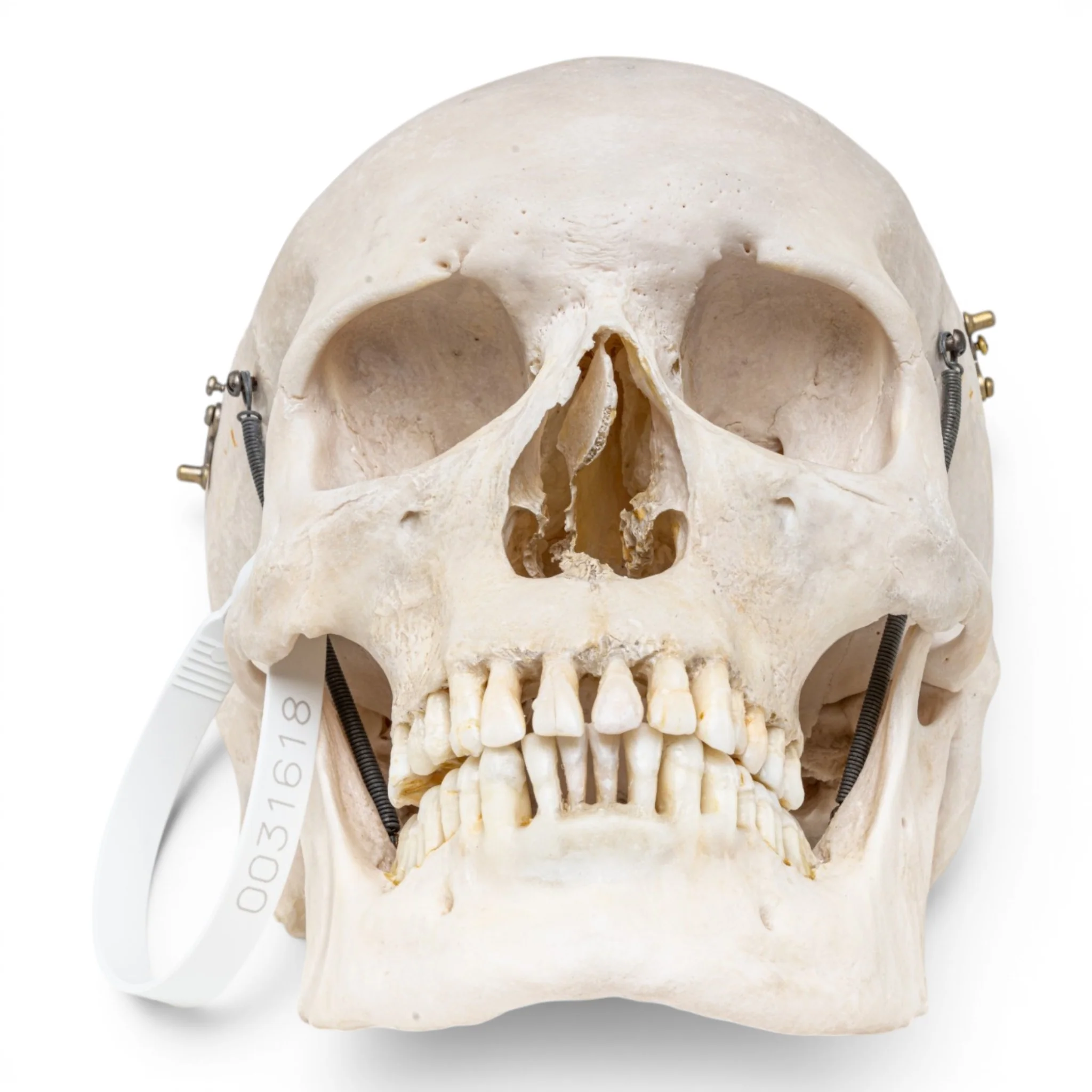 Real Human Skull - Image 3