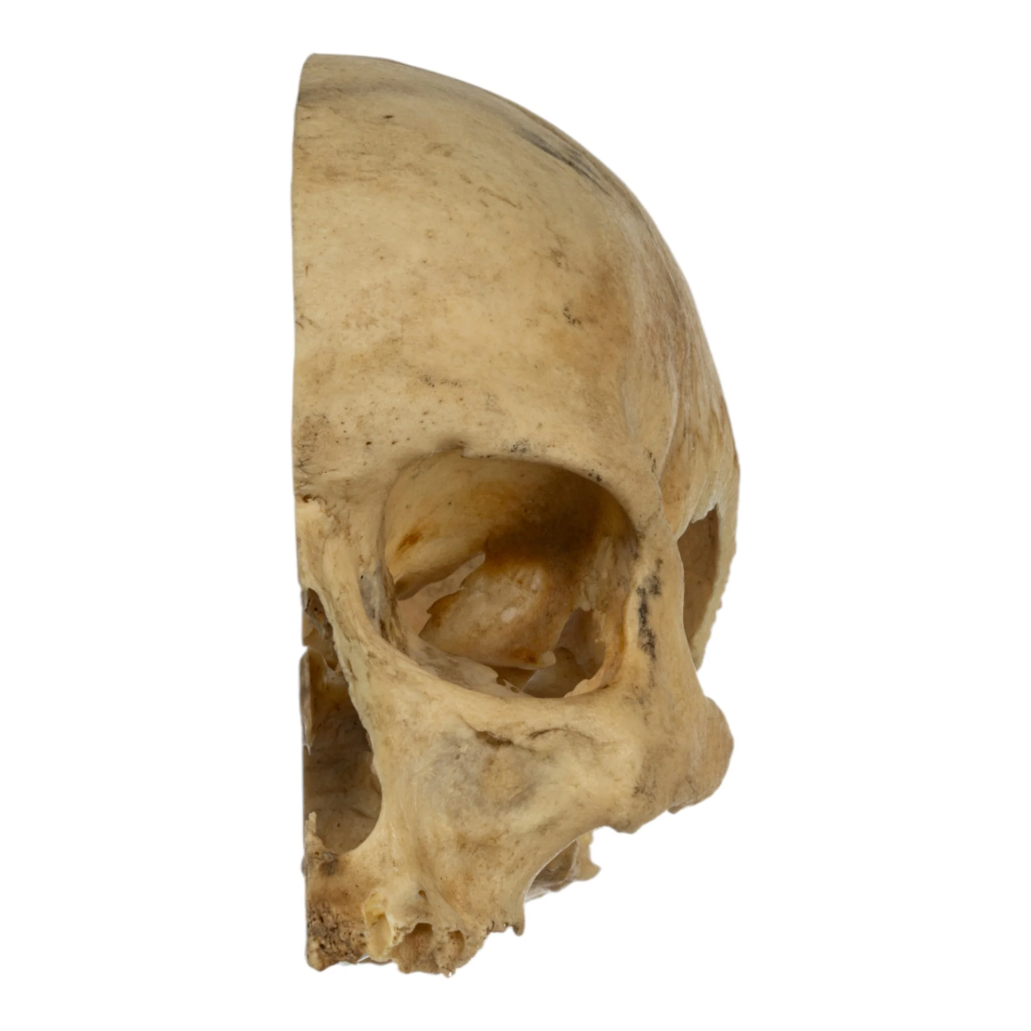 Real Human Skull - Partial - Image 3
