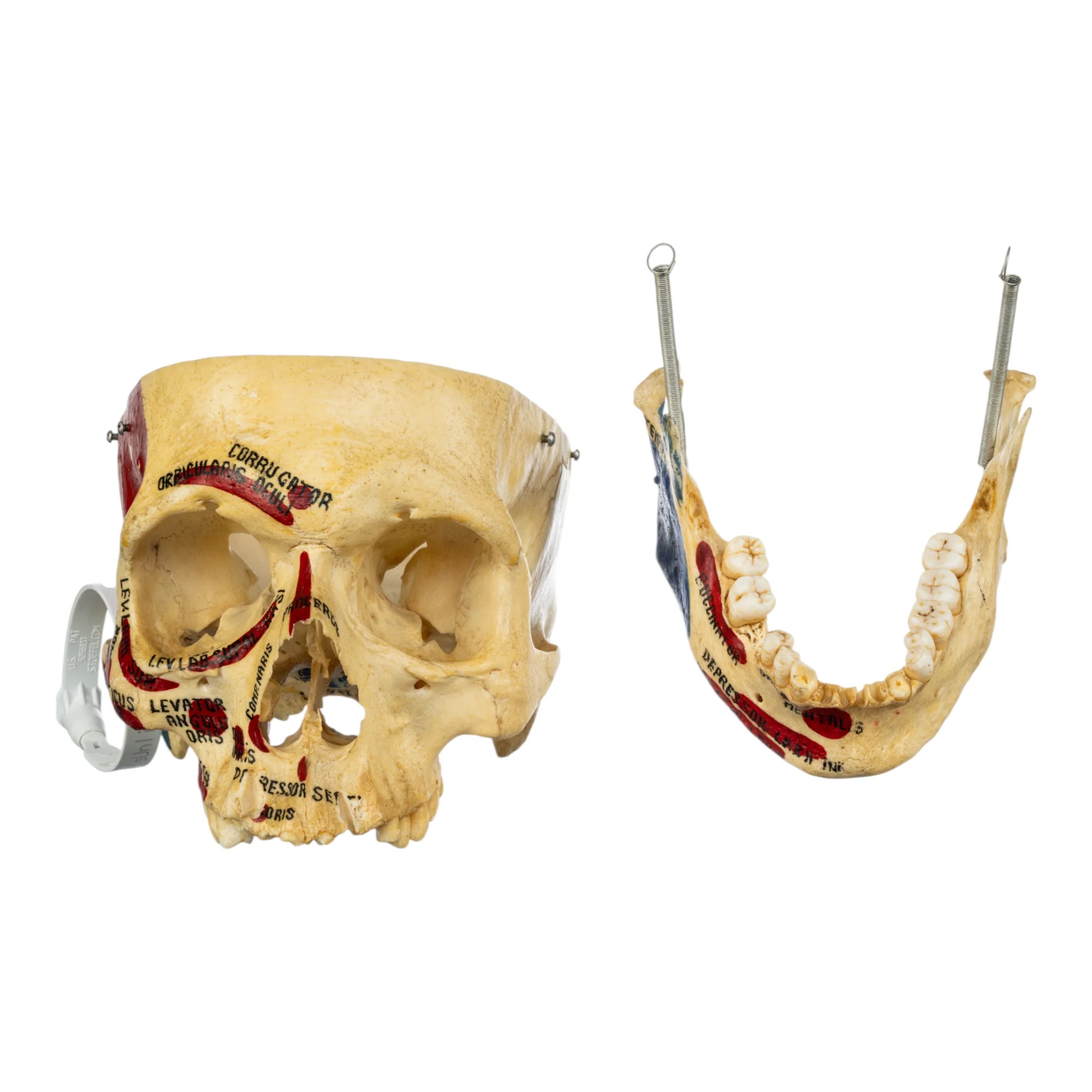 Real Human Skull - Partial, Painted - Image 8