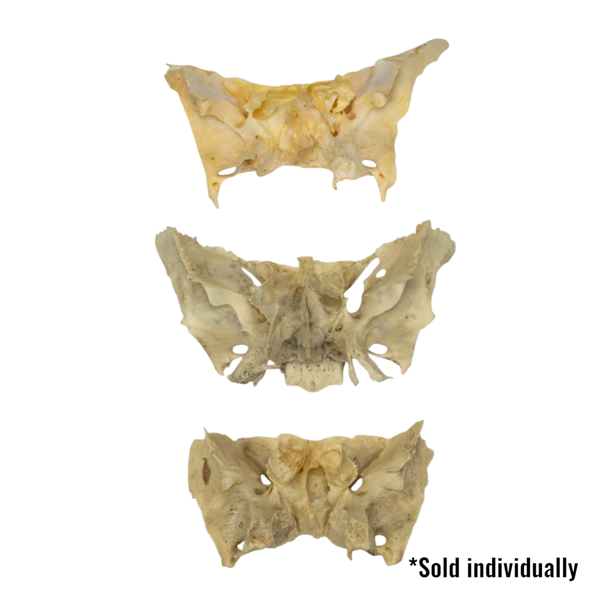 Real Human Sphenoid Bone - Damaged (Single) - Image 2