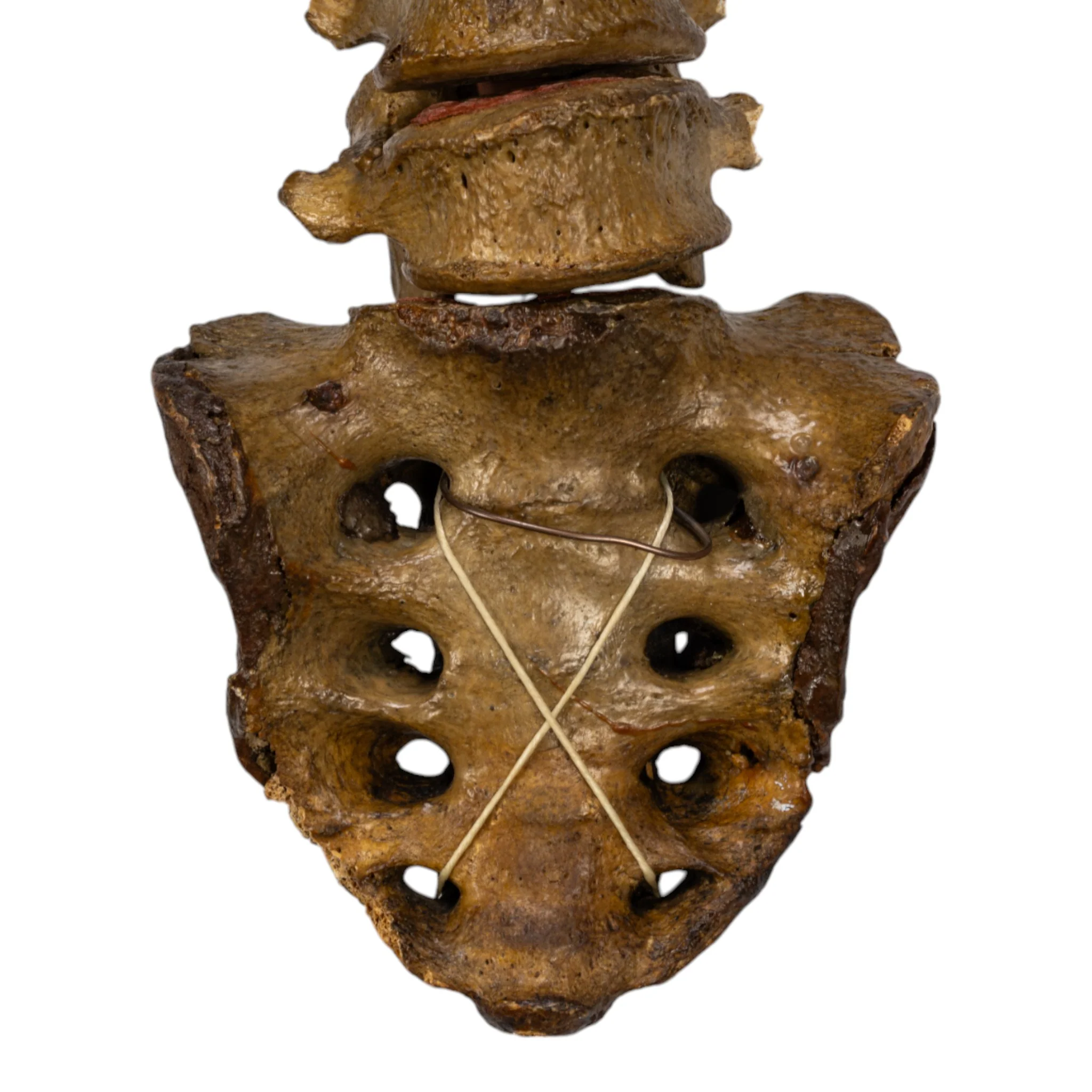 Real Human Spine and Sacrum - Antique - Image 3