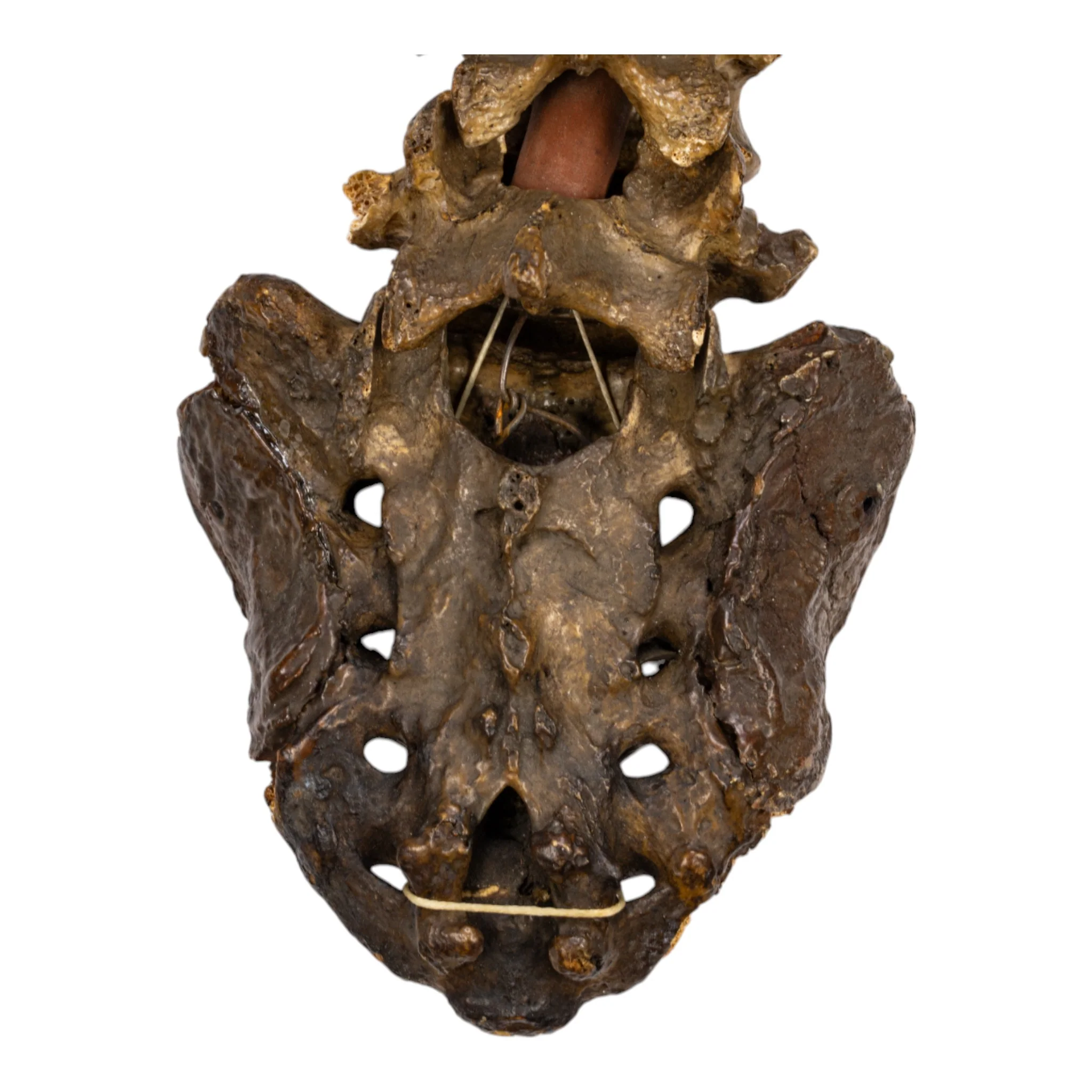 Real Human Spine and Sacrum - Antique - Image 4