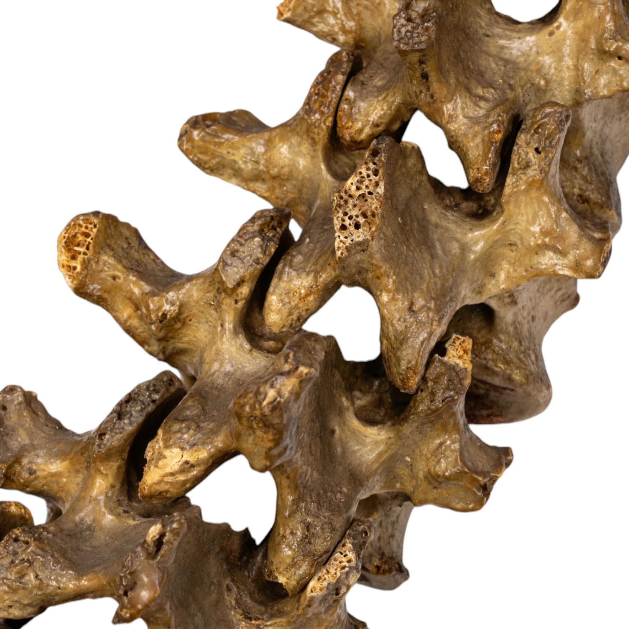 Real Human Spine and Sacrum - Antique - Image 5
