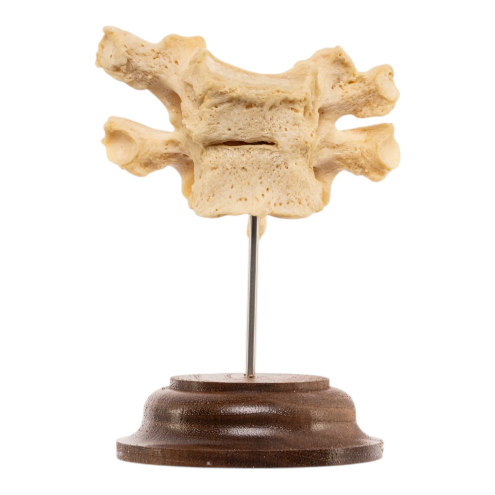 Real Human Thoracic Vertebrae - Fused - Image 5