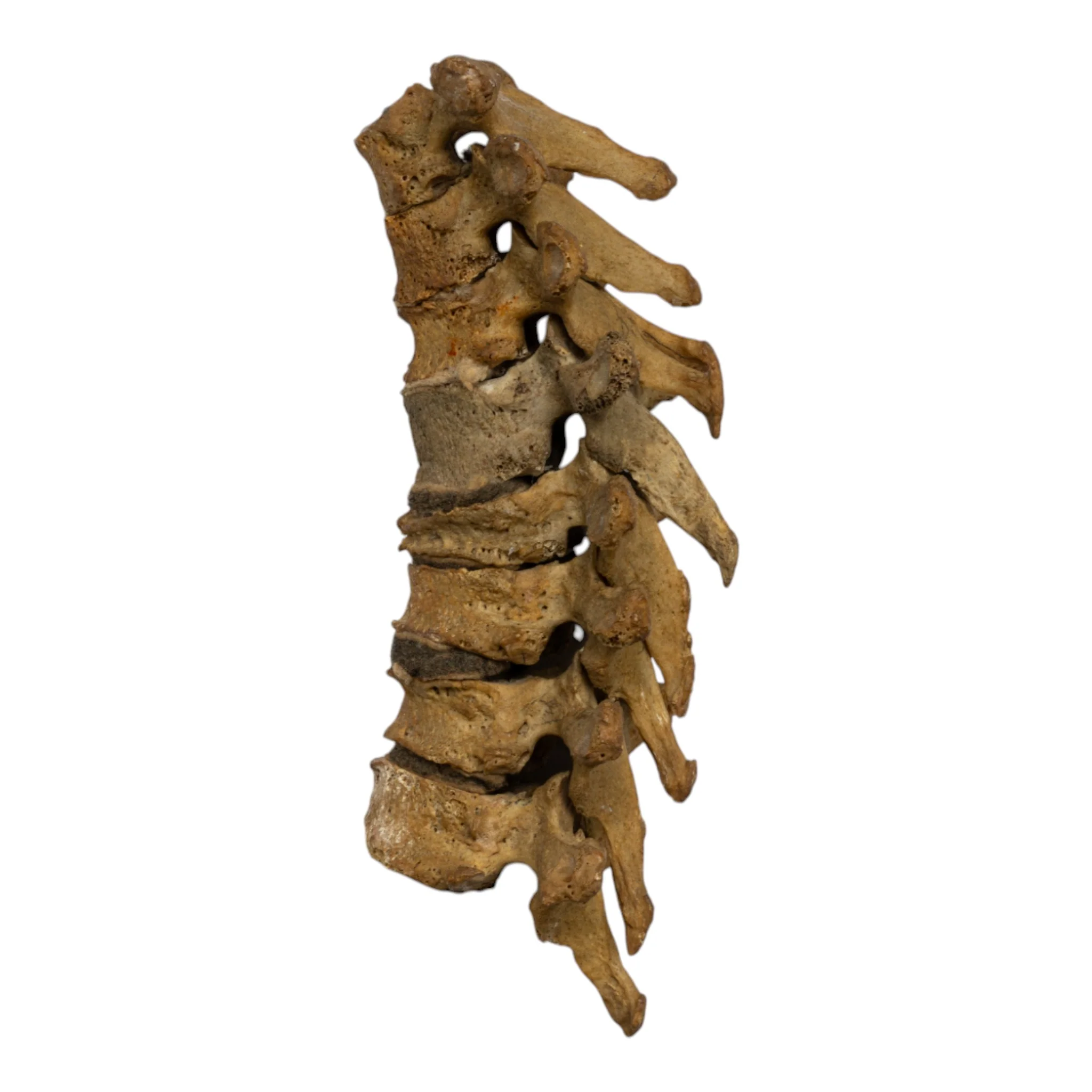 Real Human Thoracic Vertebrae - Set of 8 - Image 2