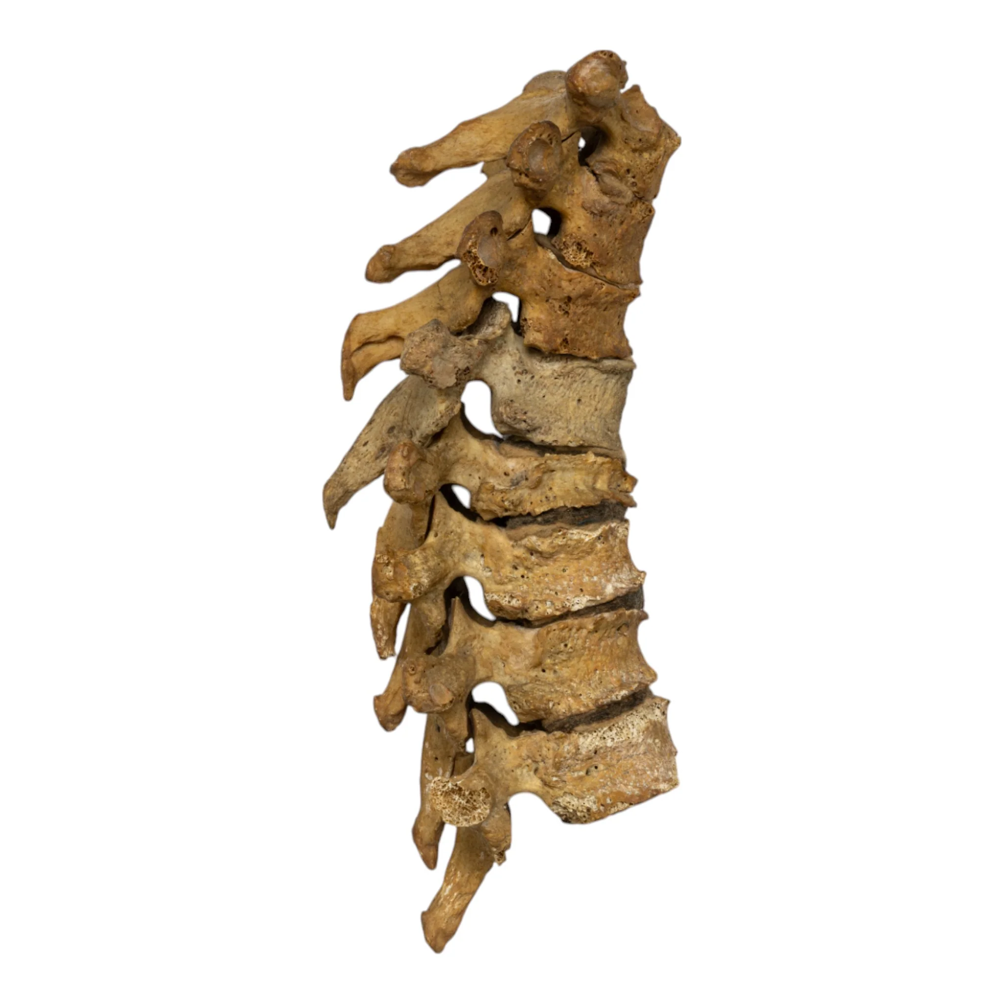 Real Human Thoracic Vertebrae - Set of 8 - Image 4