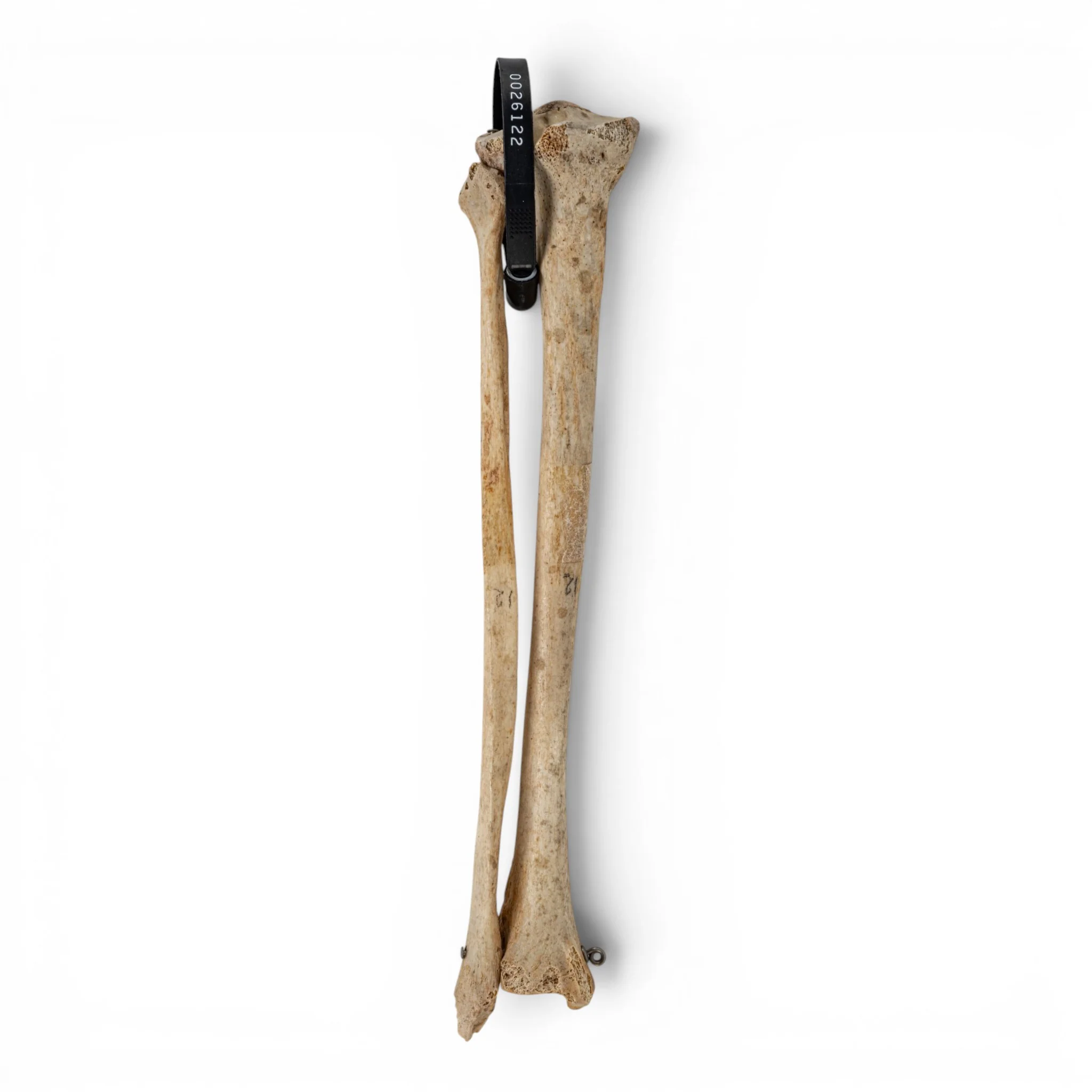 Real Human Tibia and Fibula - Image 2