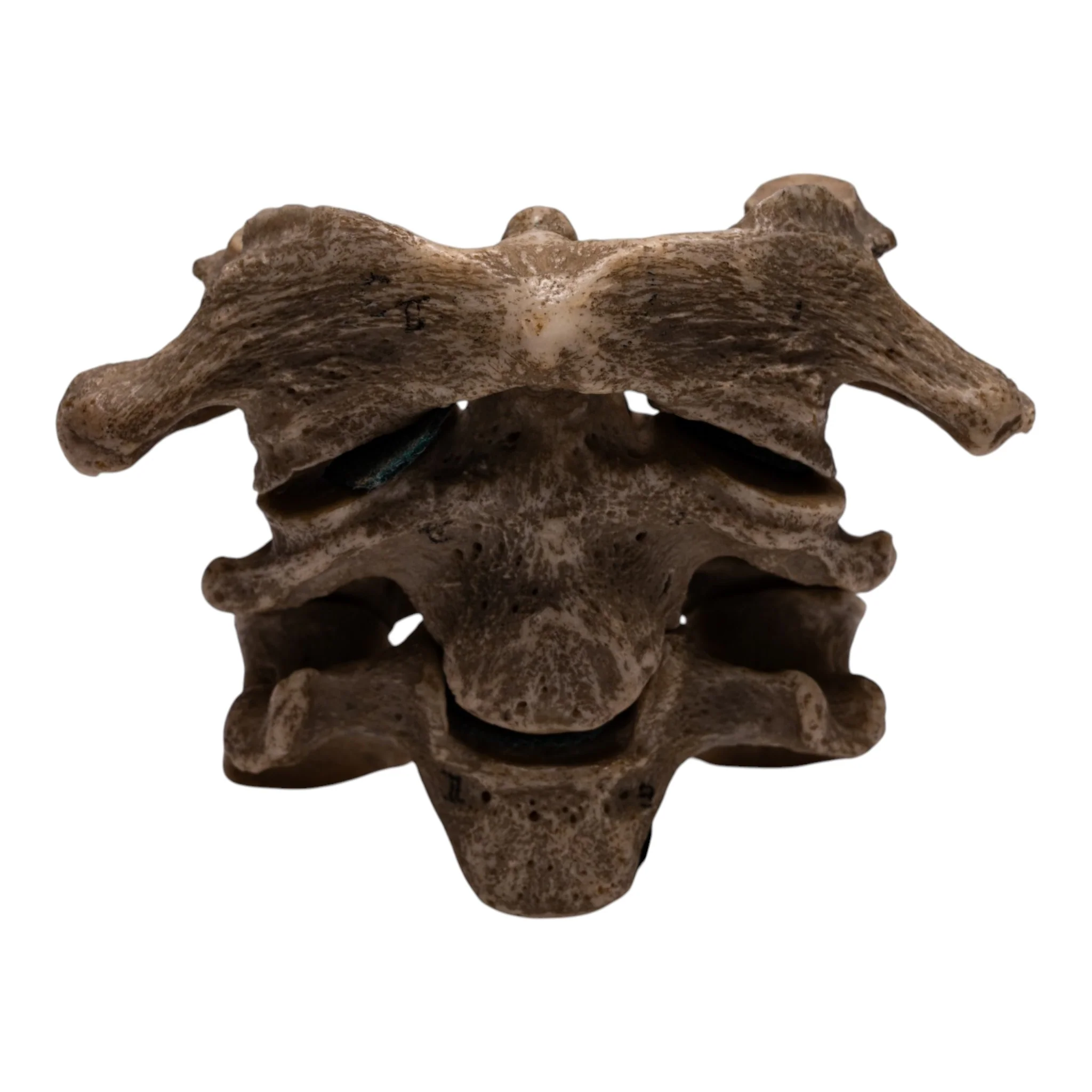 Real Human Vertebrae Set - Image 3