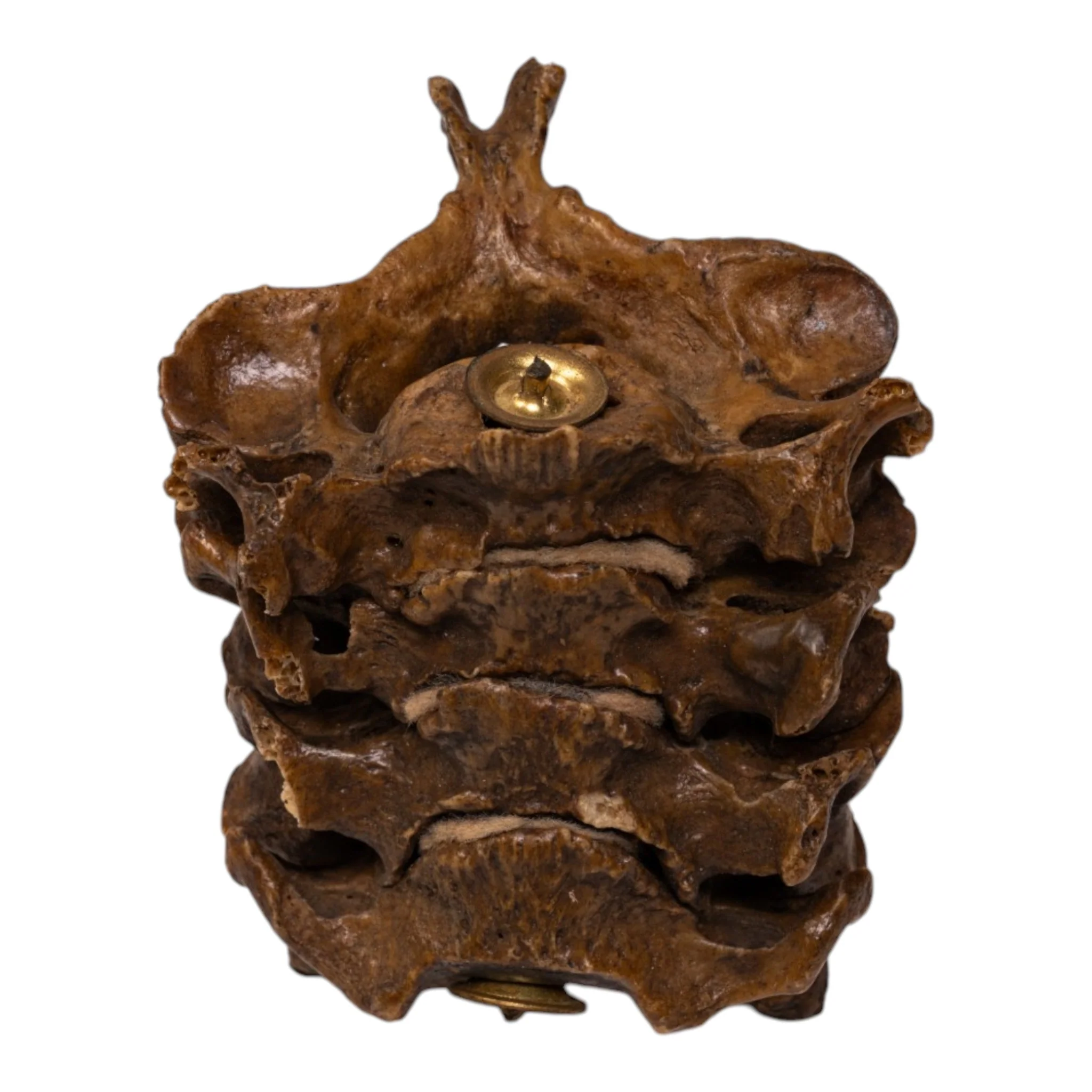 Real Human Vertebrae Set - Image 2