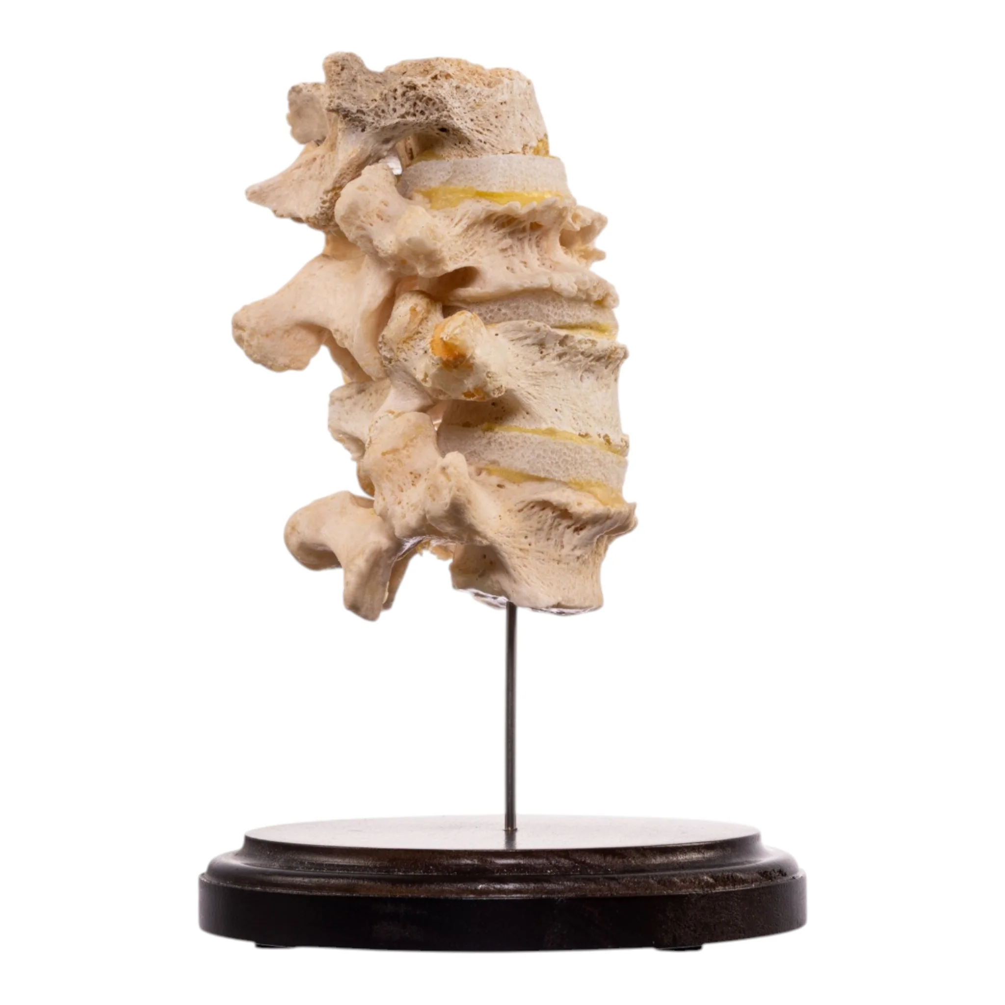 Real Human Vertebrae Set - Image 4
