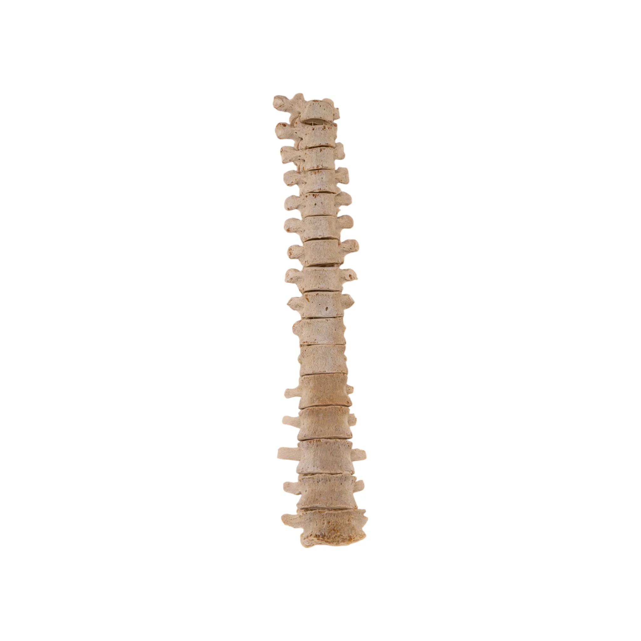 Real Loosely Strung Human Spine - Partial