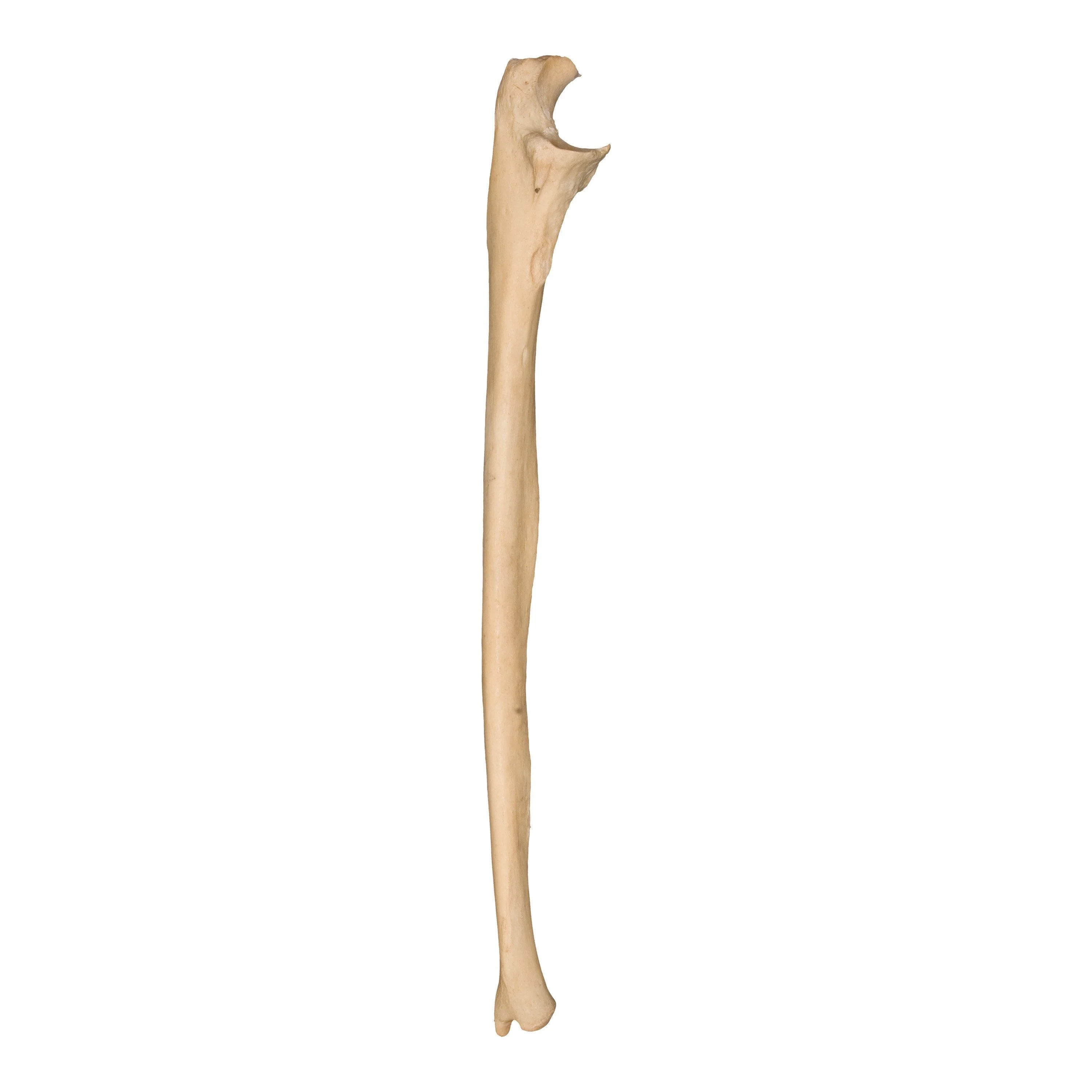 Real Human Ulna