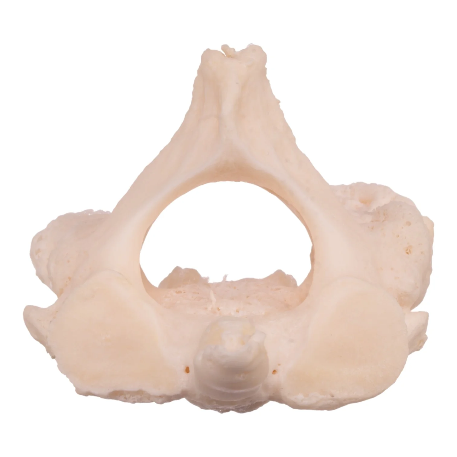 Real Research Quality Human Cervical and Axis Vertebrae - Fused - Image 3