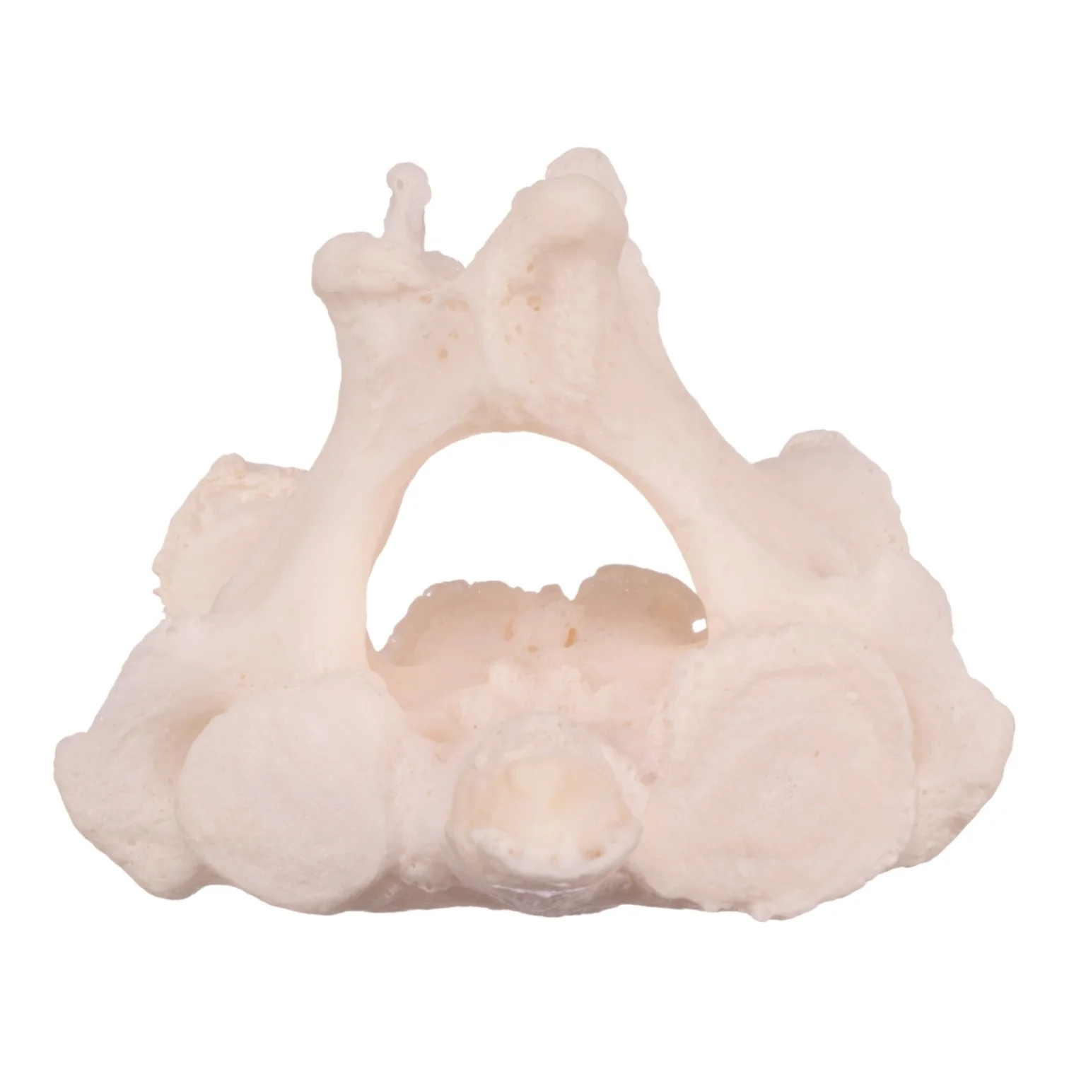 Real Research Quality Human Cervical and Axis Vertebrae - Fused - Image 3