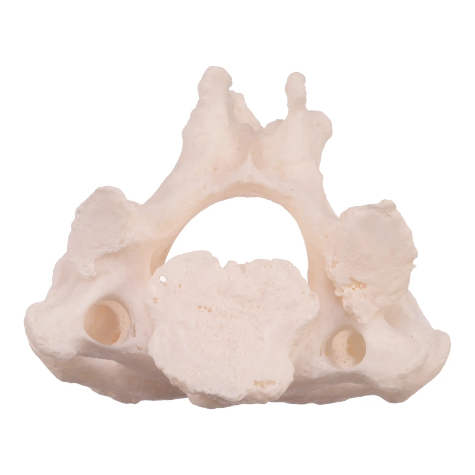 Real Research Quality Human Cervical and Axis Vertebrae - Fused - Image 5