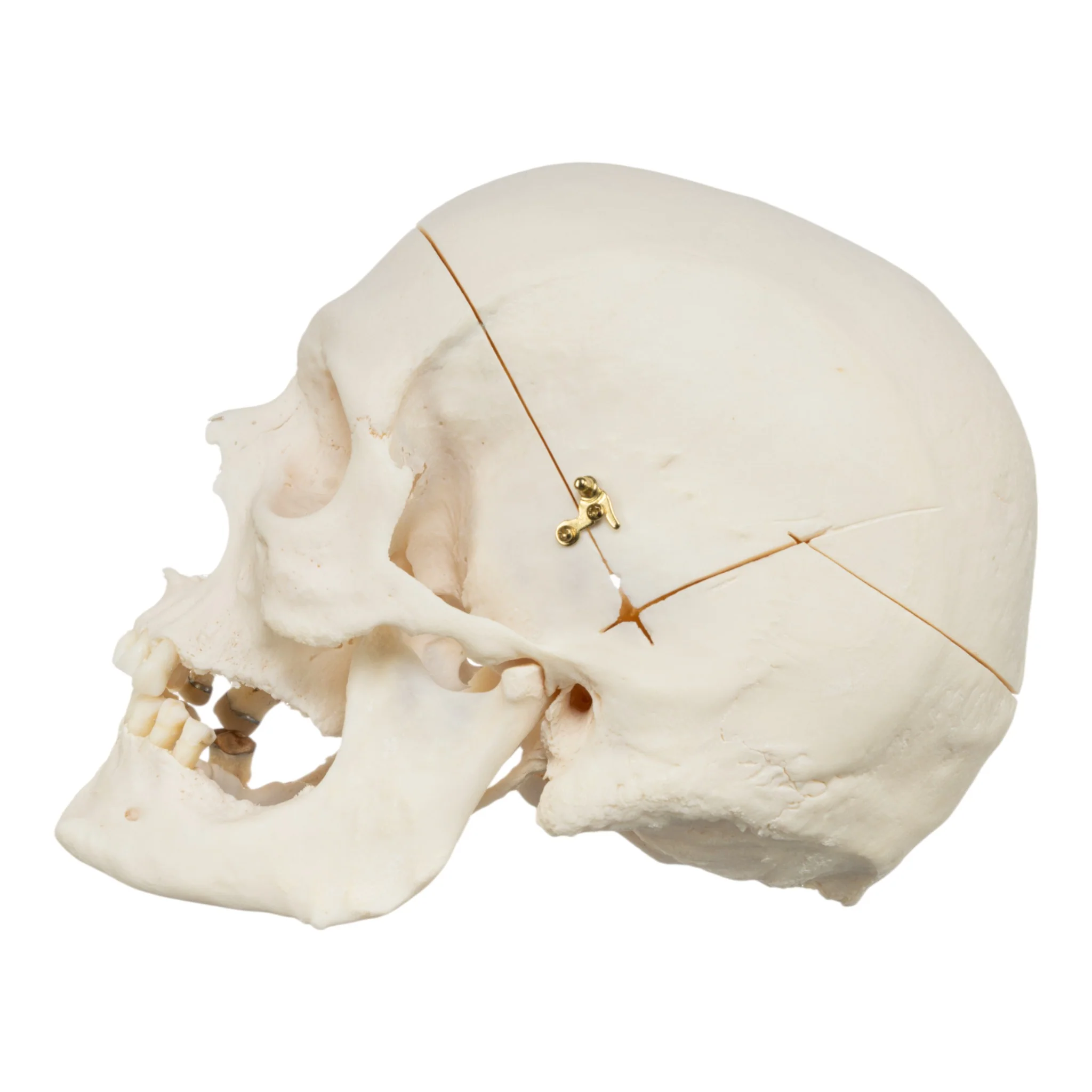 Real Research Quality Human Skull - Image 4