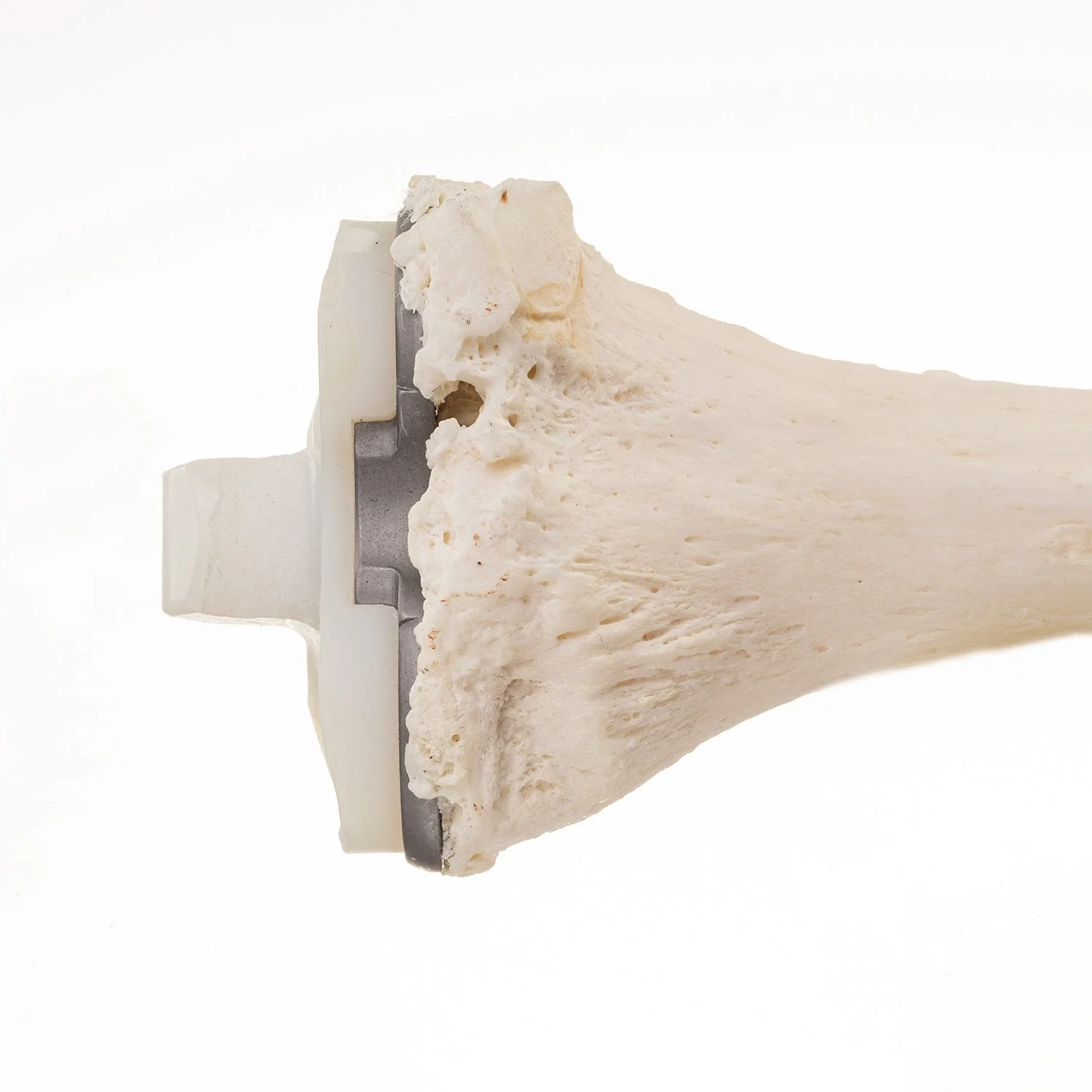 Real Research Quality Human Tibia - Image 4